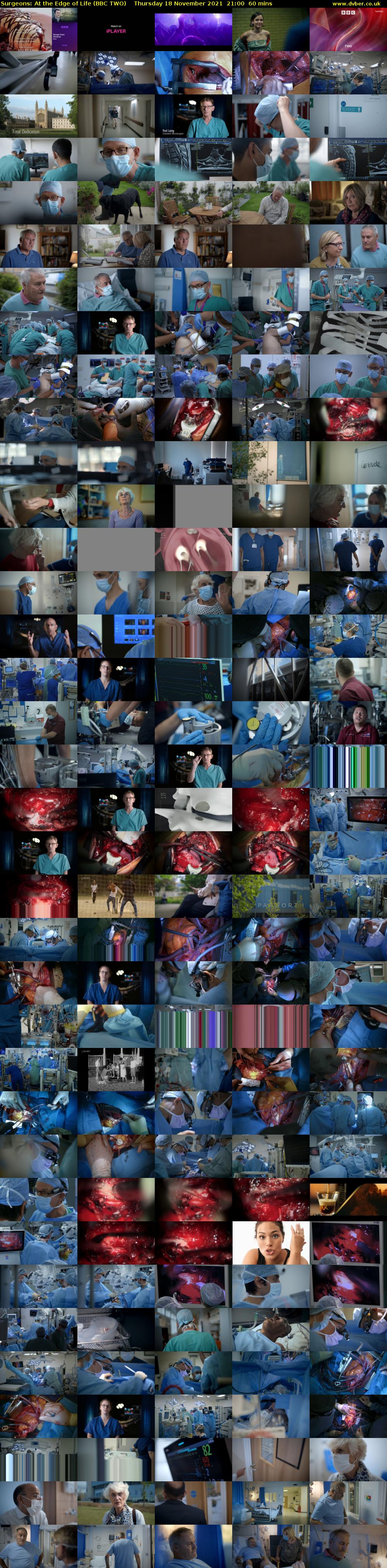 Surgeons: At the Edge of Life (BBC TWO) Thursday 18 November 2021 21:00 - 22:00
