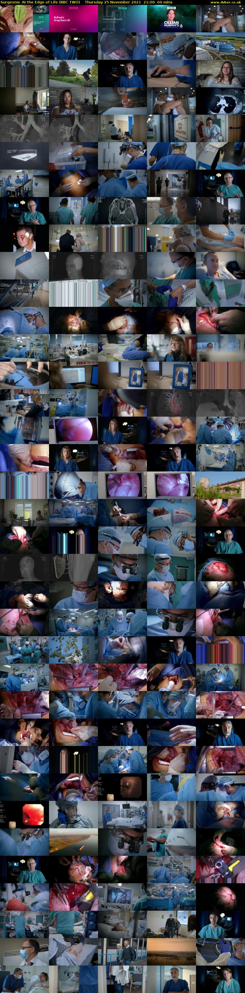 Surgeons: At the Edge of Life (BBC TWO) Thursday 25 November 2021 21:00 - 22:00