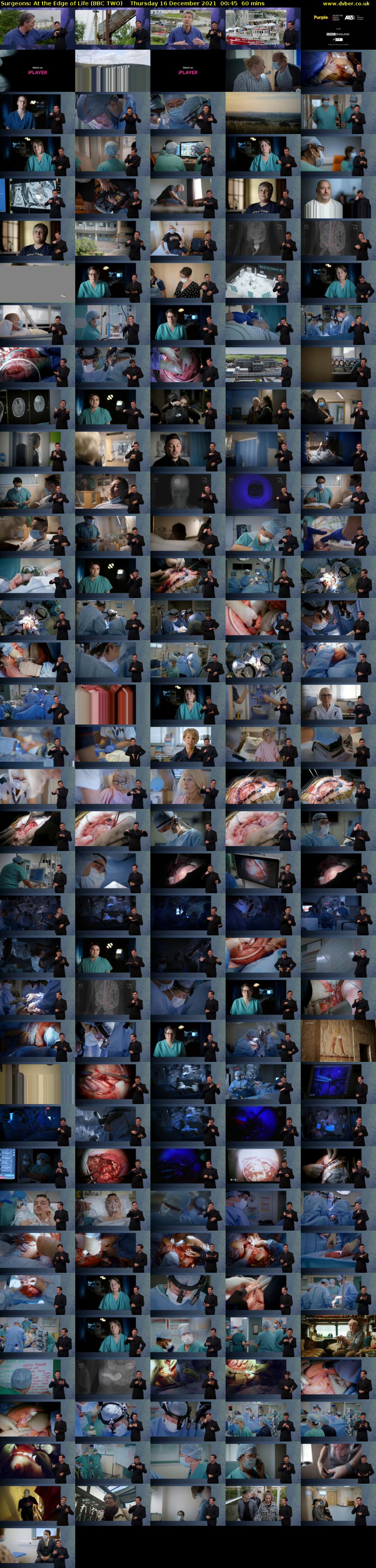 Surgeons: At the Edge of Life (BBC TWO) Thursday 16 December 2021 00:45 - 01:45