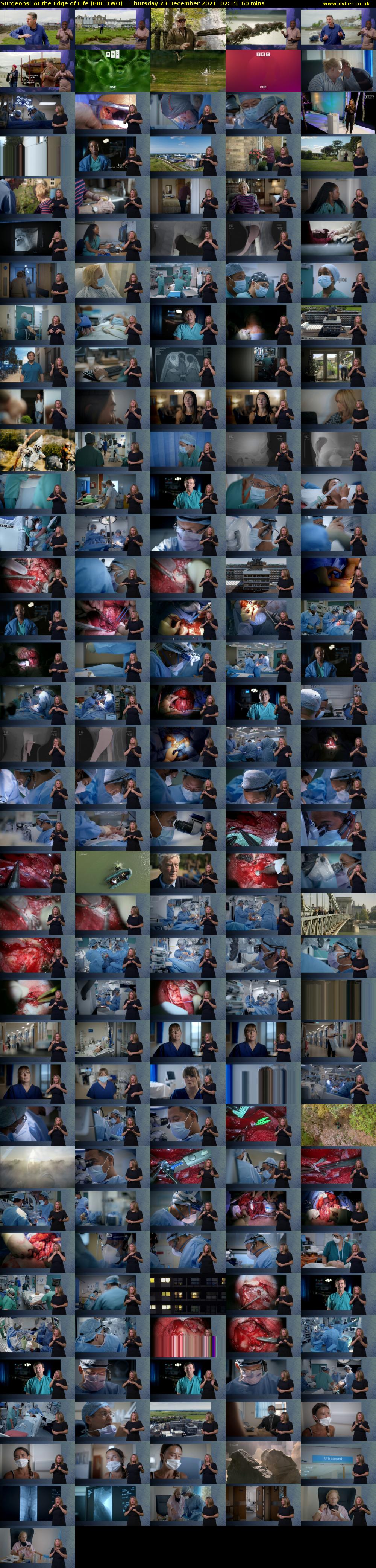 Surgeons: At the Edge of Life (BBC TWO) Thursday 23 December 2021 02:15 - 03:15