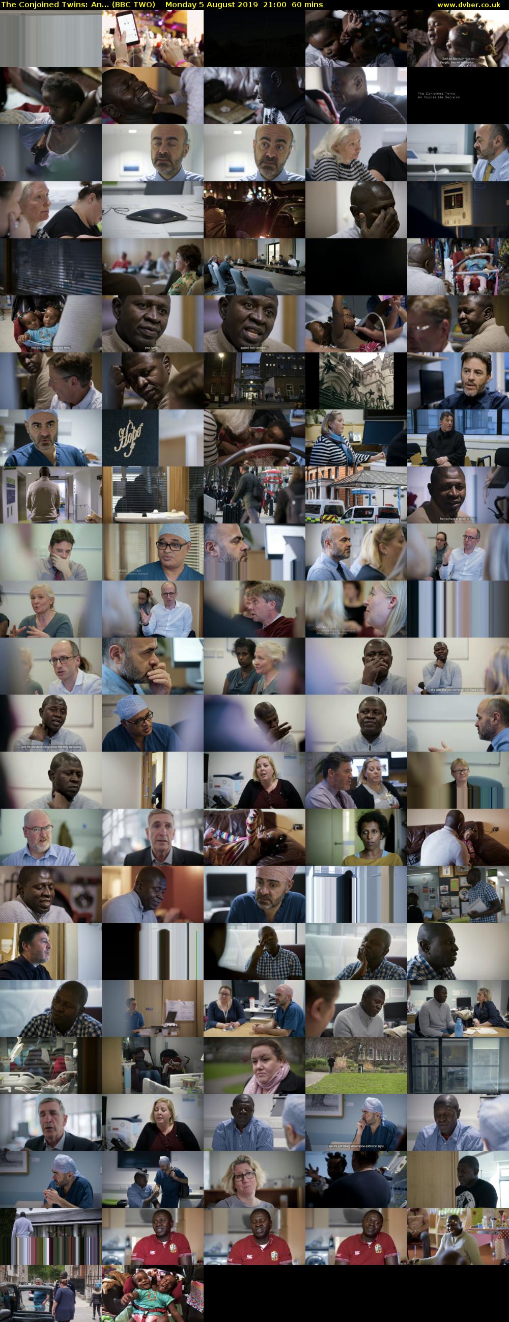 The Conjoined Twins: An... (BBC TWO) Monday 5 August 2019 21:00 - 22:00