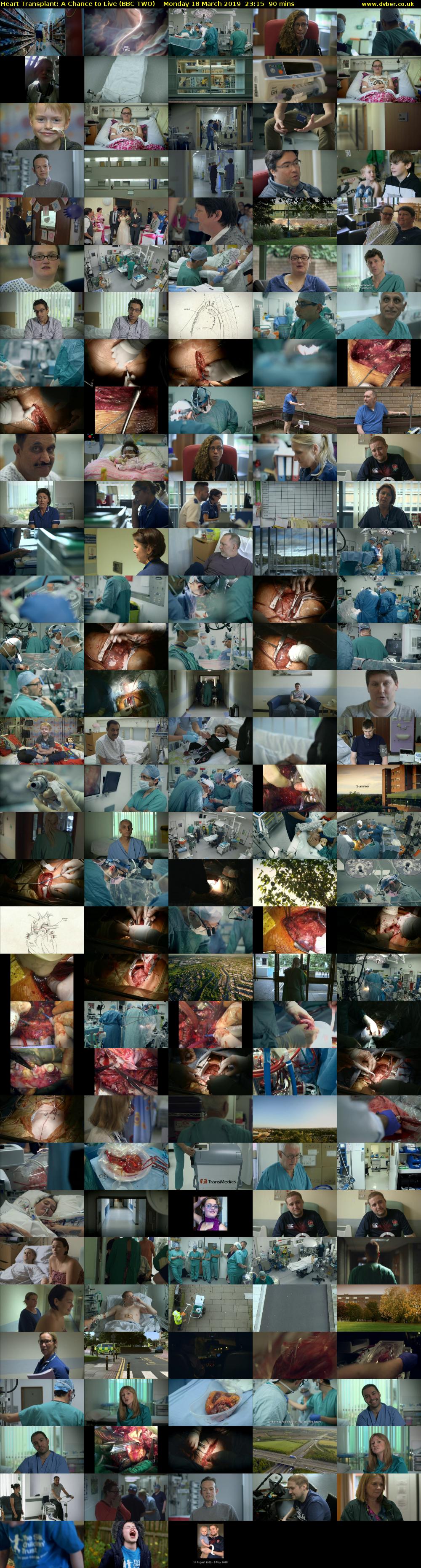 Heart Transplant: A Chance to Live (BBC TWO) Monday 18 March 2019 23:15 - 00:45