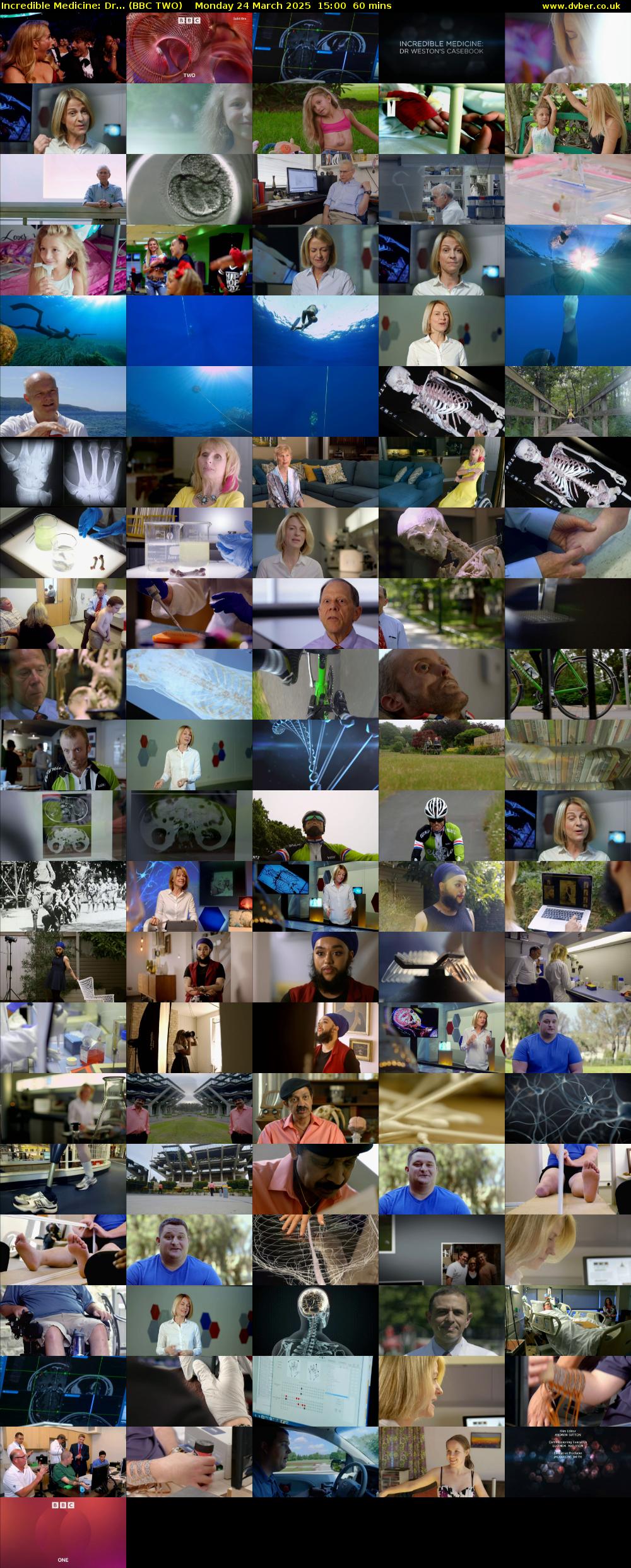 Incredible Medicine: Dr... (BBC TWO) Monday 24 March 2025 15:00 - 16:00