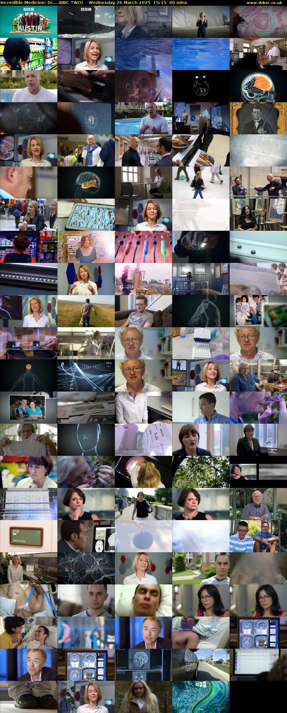 Incredible Medicine: Dr... (BBC TWO) Wednesday 26 March 2025 15:15 - 16:15