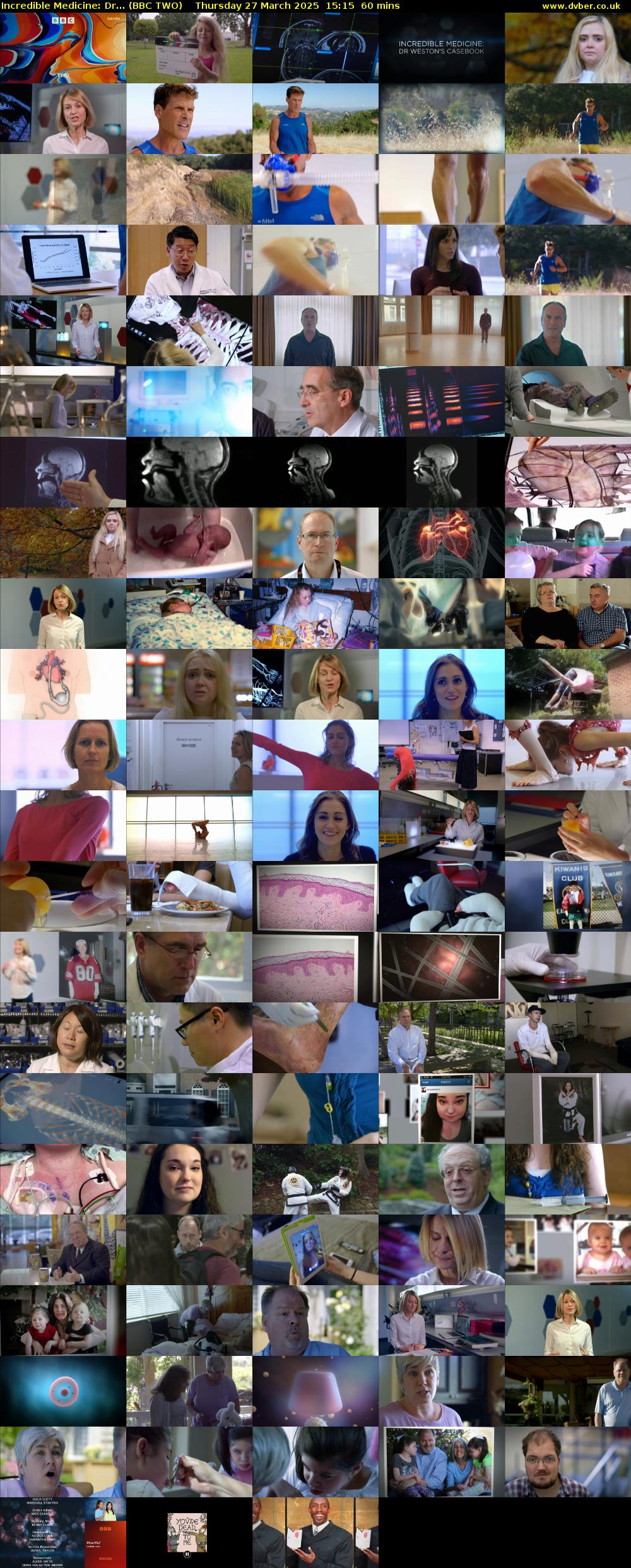 Incredible Medicine: Dr... (BBC TWO) Thursday 27 March 2025 15:15 - 16:15