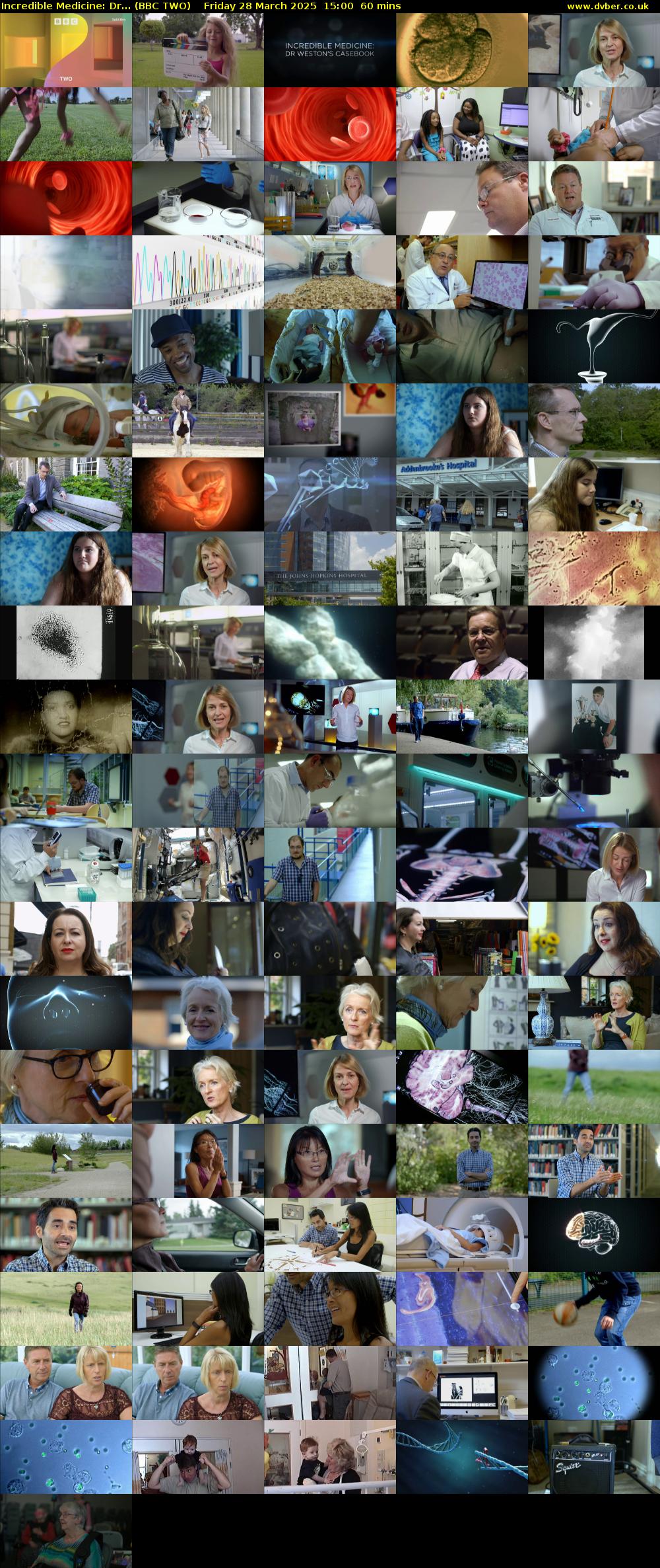 Incredible Medicine: Dr... (BBC TWO) Friday 28 March 2025 15:00 - 16:00