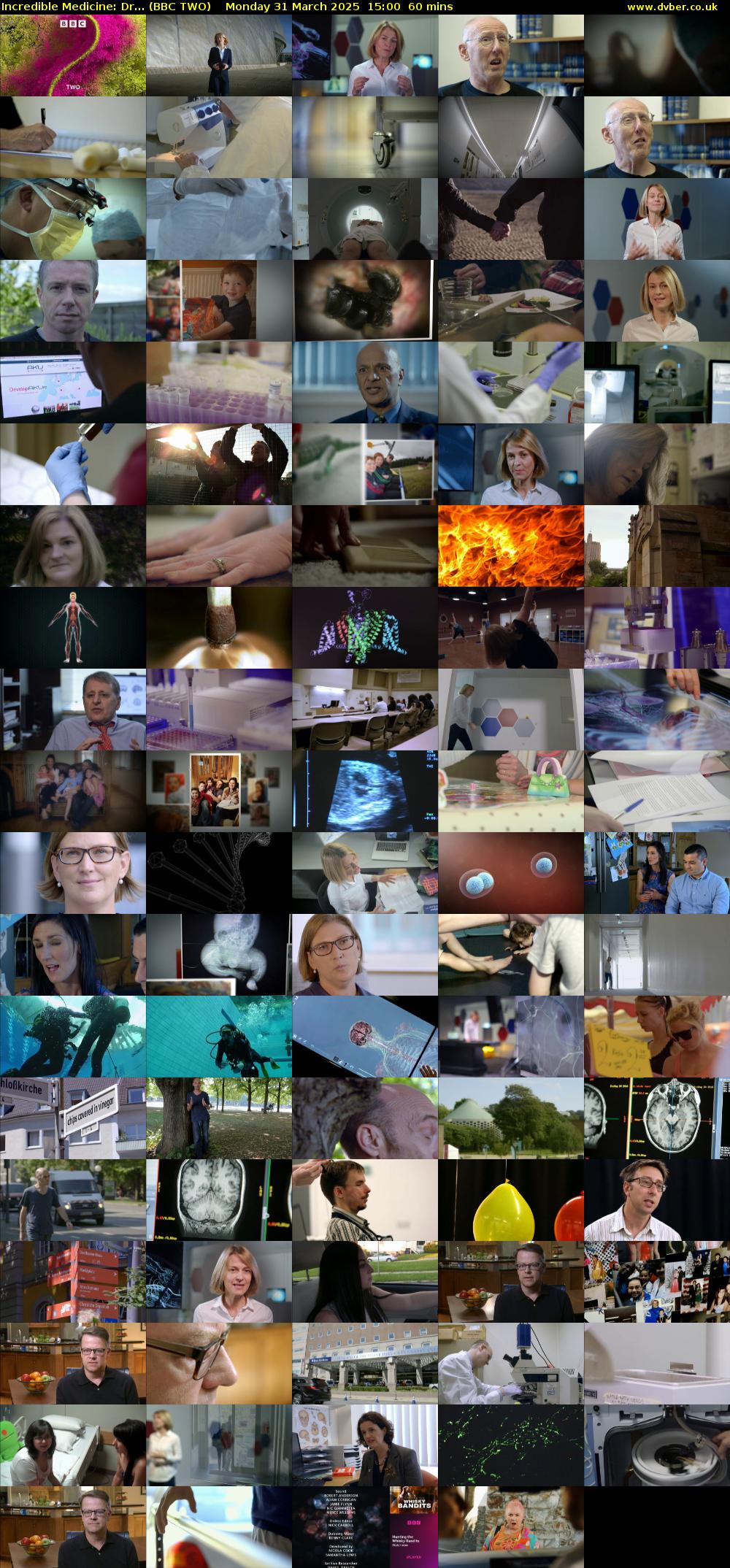 Incredible Medicine: Dr... (BBC TWO) Monday 31 March 2025 15:00 - 16:00