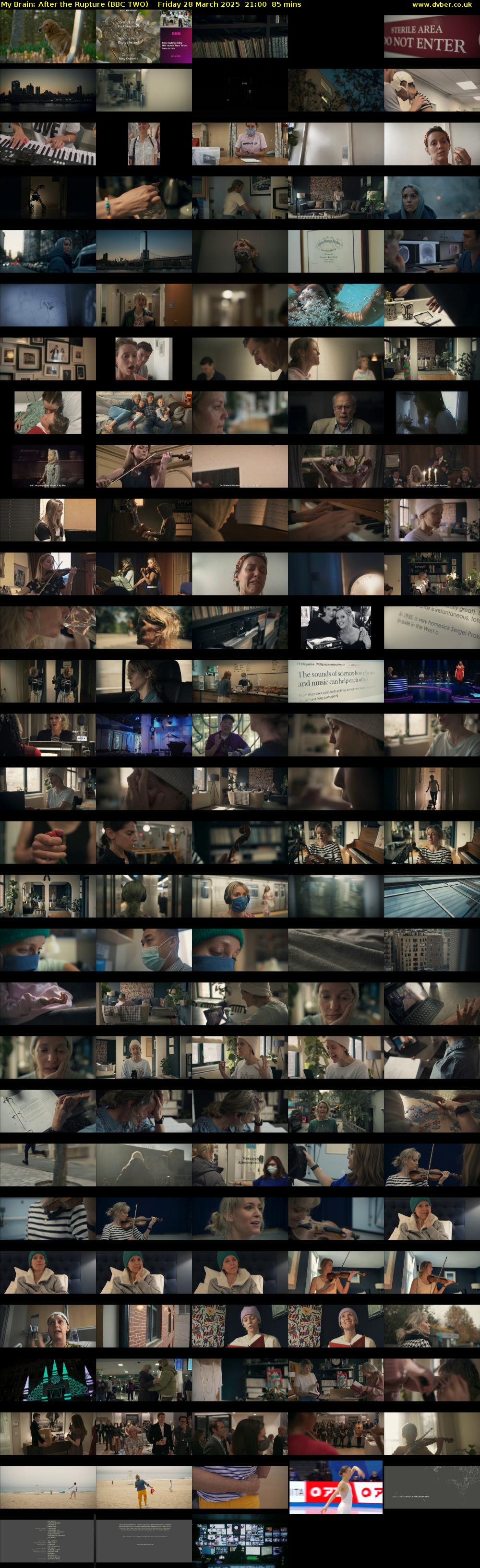 My Brain: After the Rupture (BBC TWO) Friday 28 March 2025 21:00 - 22:25