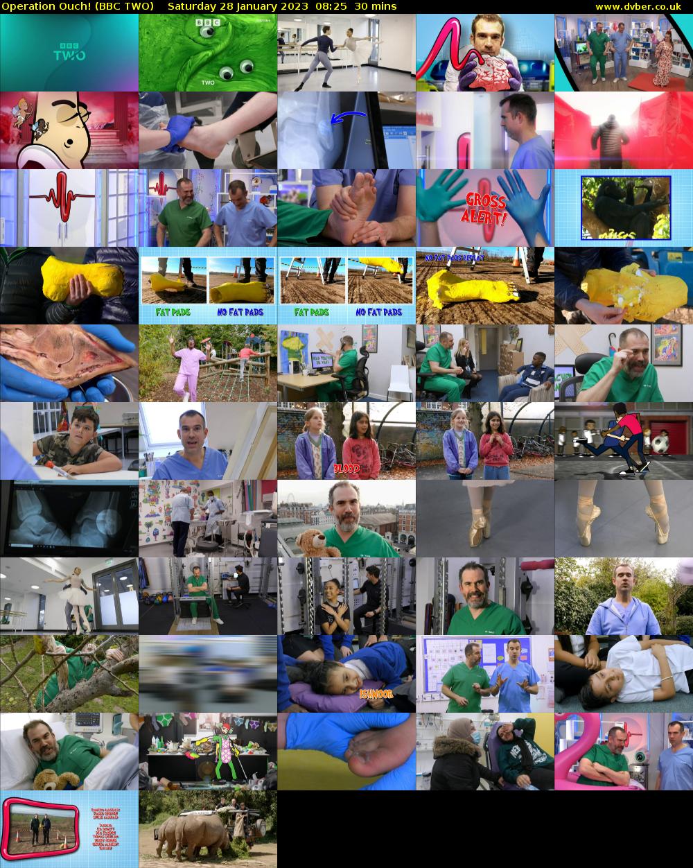 Operation Ouch! (BBC TWO) Saturday 28 January 2023 08:25 - 08:55