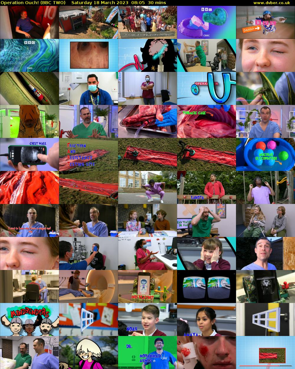Operation Ouch! (BBC TWO) Saturday 18 March 2023 08:05 - 08:35