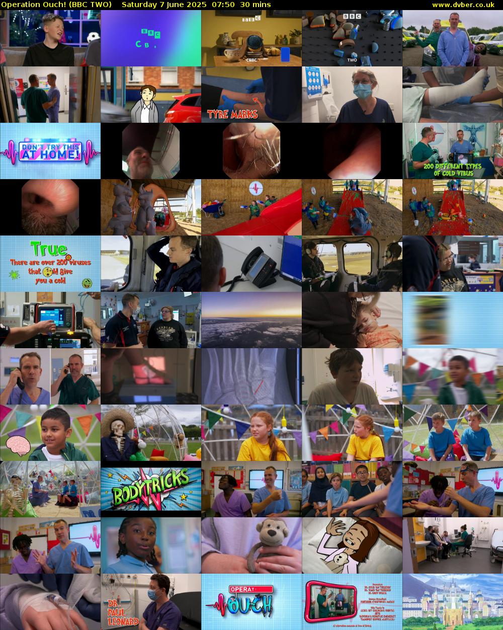 Operation Ouch! (BBC TWO) Saturday 7 June 2025 07:50 - 08:20