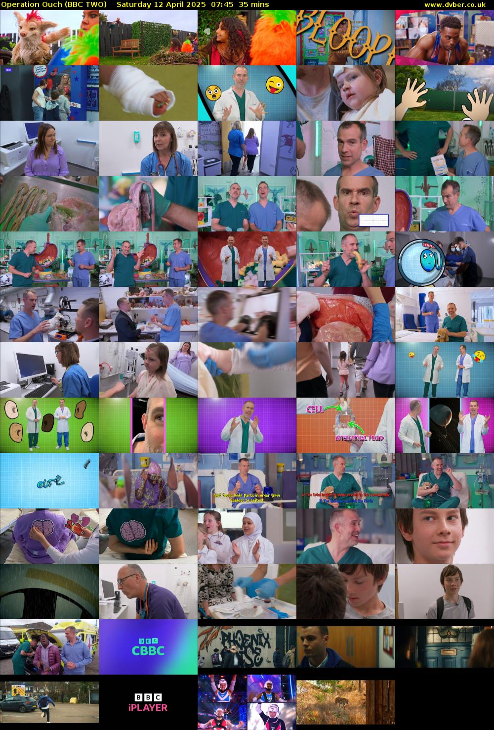 Operation Ouch (BBC TWO) Saturday 12 April 2025 07:45 - 08:20