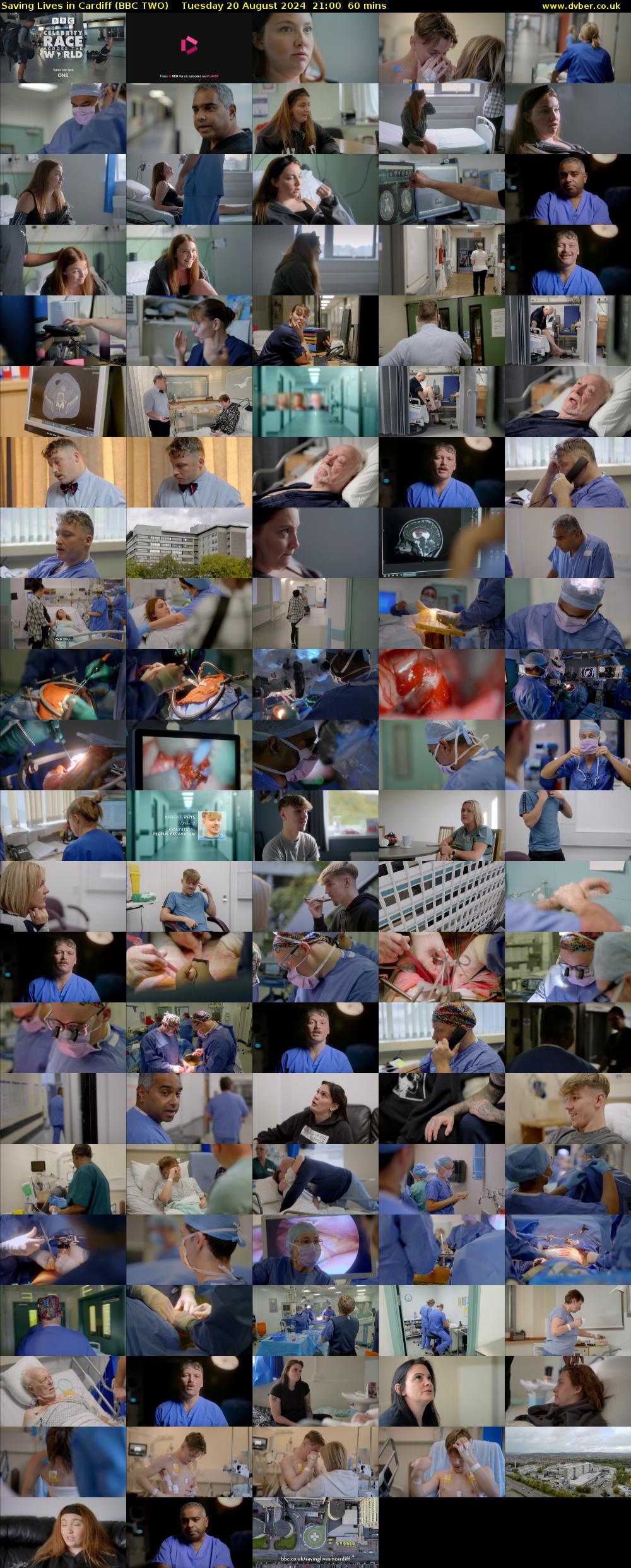 Saving Lives in Cardiff (BBC TWO) Tuesday 20 August 2024 21:00 - 22:00