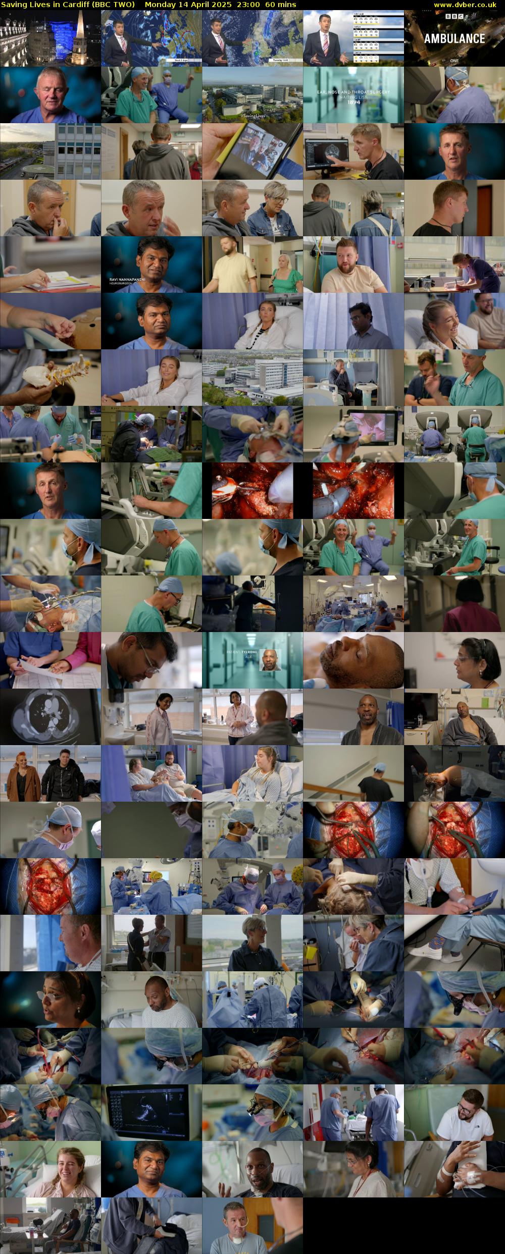 Saving Lives in Cardiff (BBC TWO) Monday 14 April 2025 23:00 - 00:00