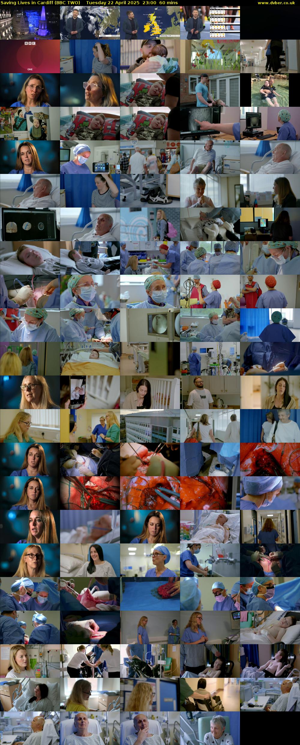 Saving Lives in Cardiff (BBC TWO) Tuesday 22 April 2025 23:00 - 00:00