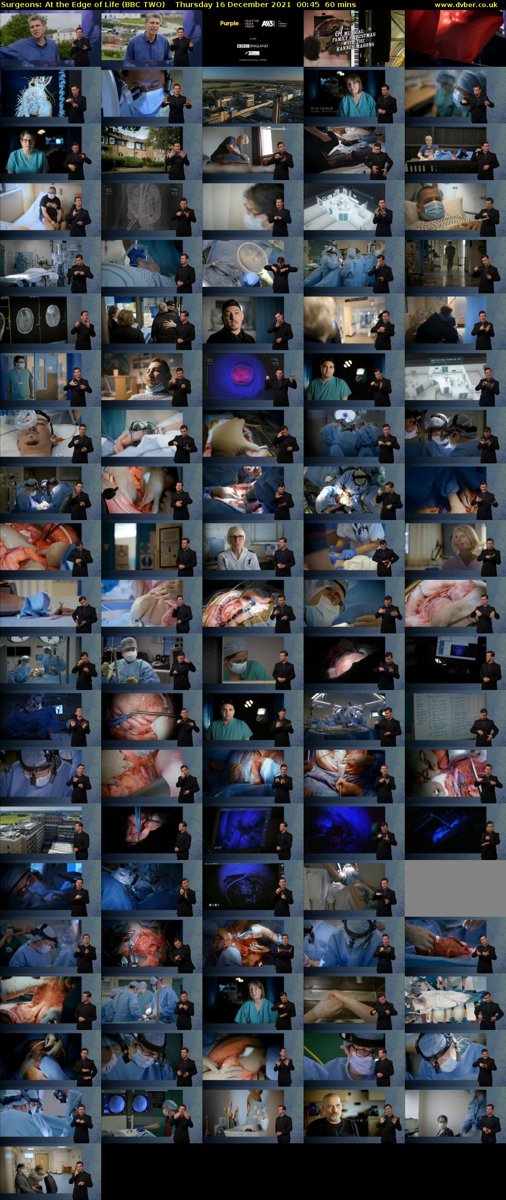 Surgeons: At the Edge of Life (BBC TWO) Thursday 16 December 2021 00:45 - 01:45
