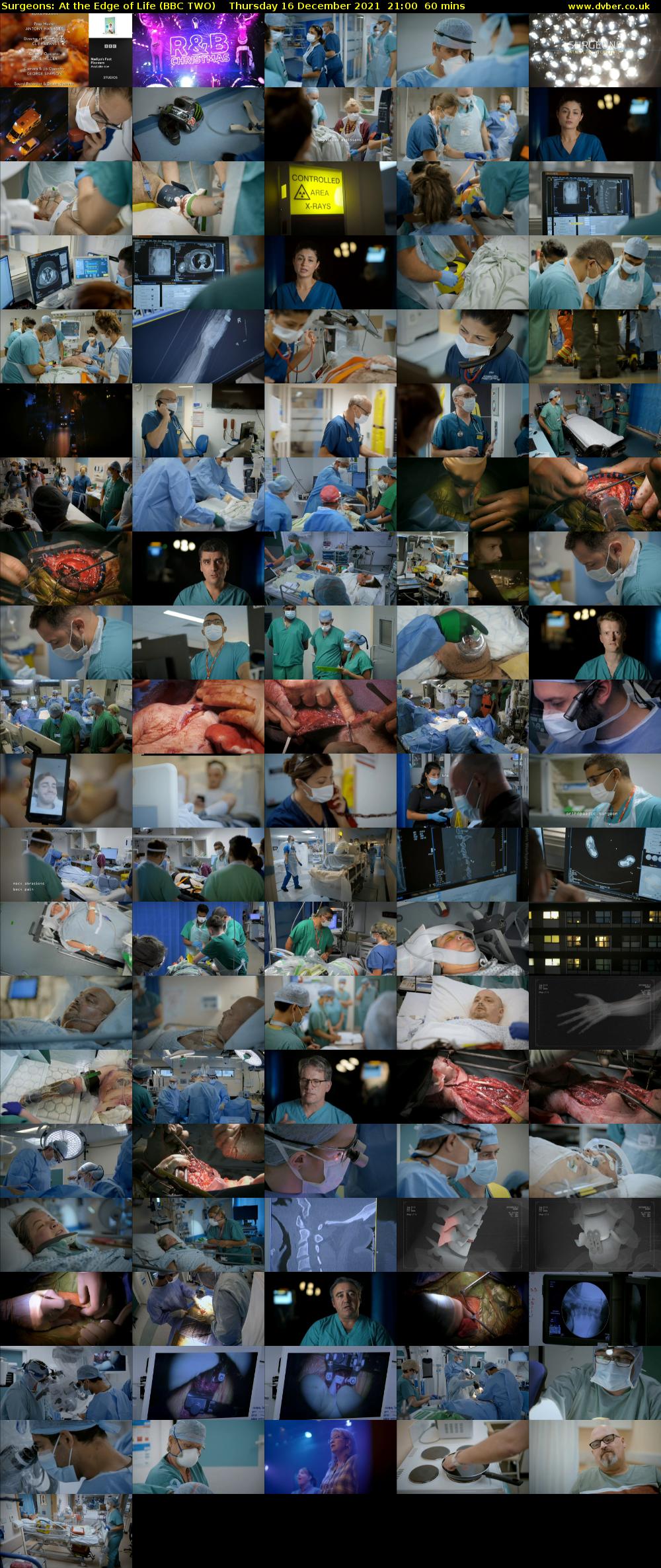 Surgeons: At the Edge of Life (BBC TWO) Thursday 16 December 2021 21:00 - 22:00