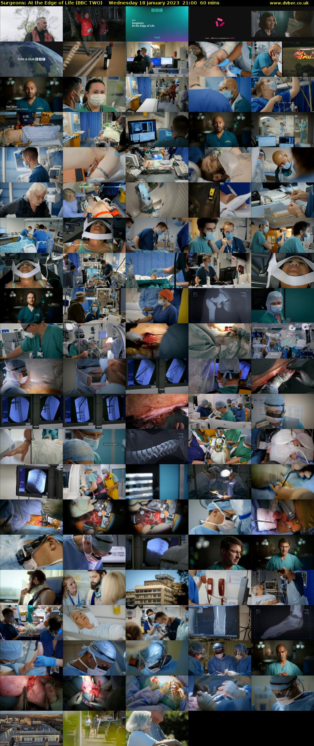 Surgeons: At the Edge of Life (BBC TWO) Wednesday 18 January 2023 21:00 - 22:00