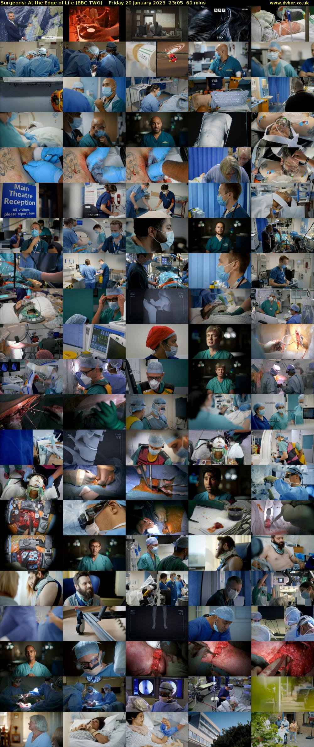 Surgeons: At the Edge of Life (BBC TWO) Friday 20 January 2023 23:05 - 00:05
