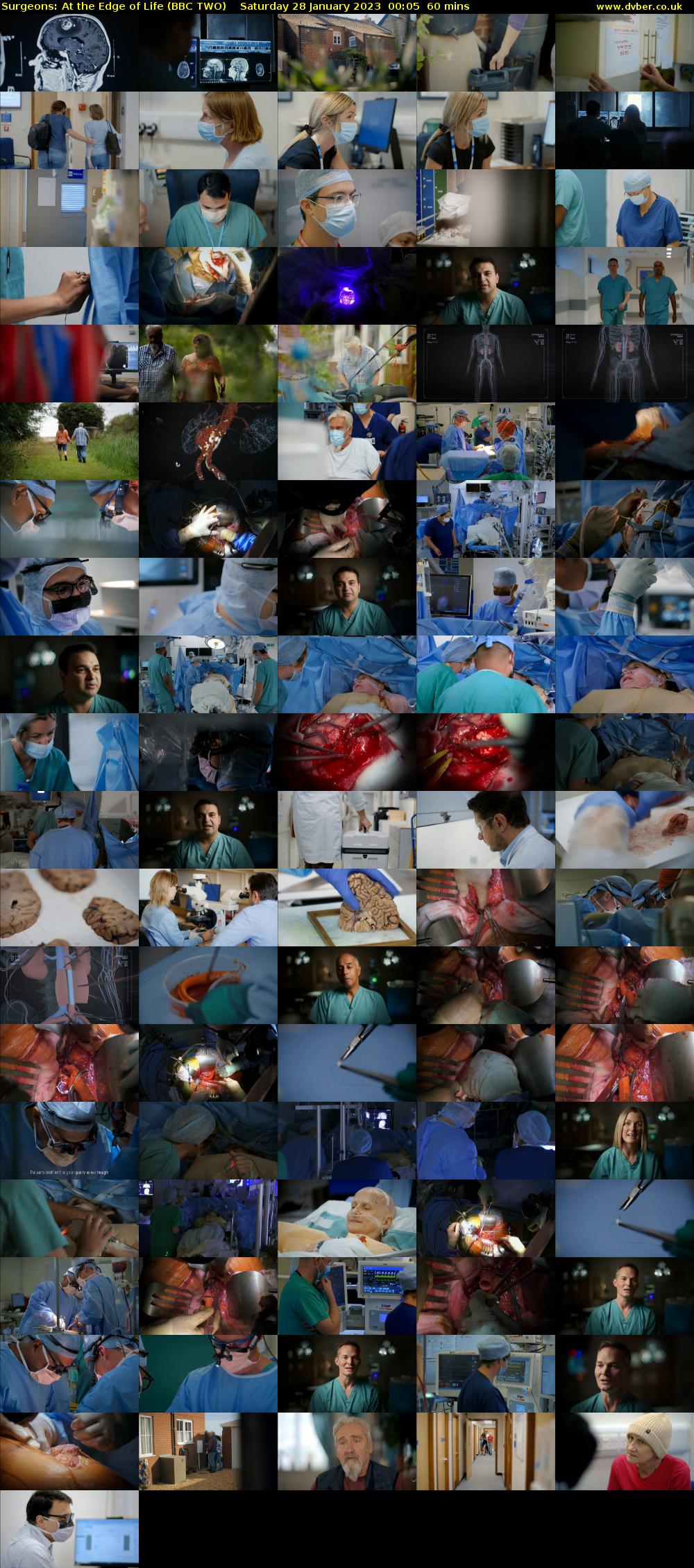 Surgeons: At the Edge of Life (BBC TWO) Saturday 28 January 2023 00:05 - 01:05
