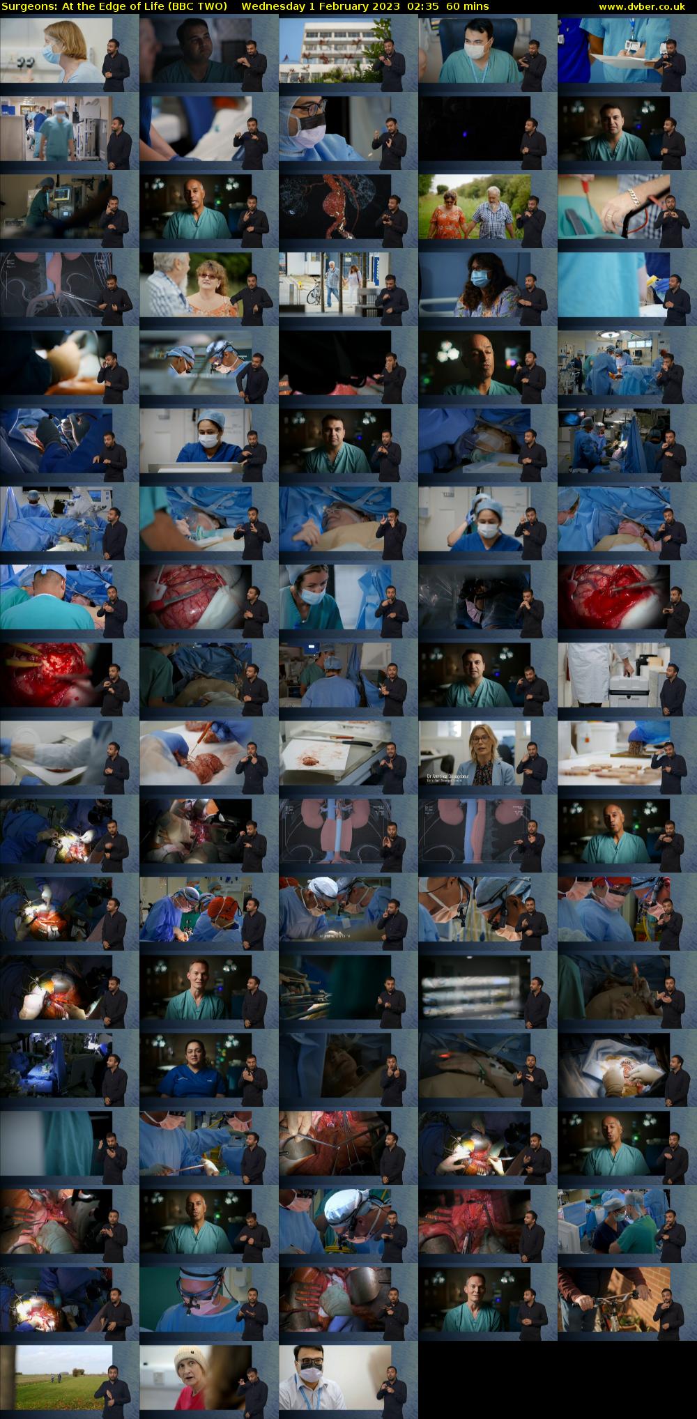 Surgeons: At the Edge of Life (BBC TWO) Wednesday 1 February 2023 02:35 - 03:35