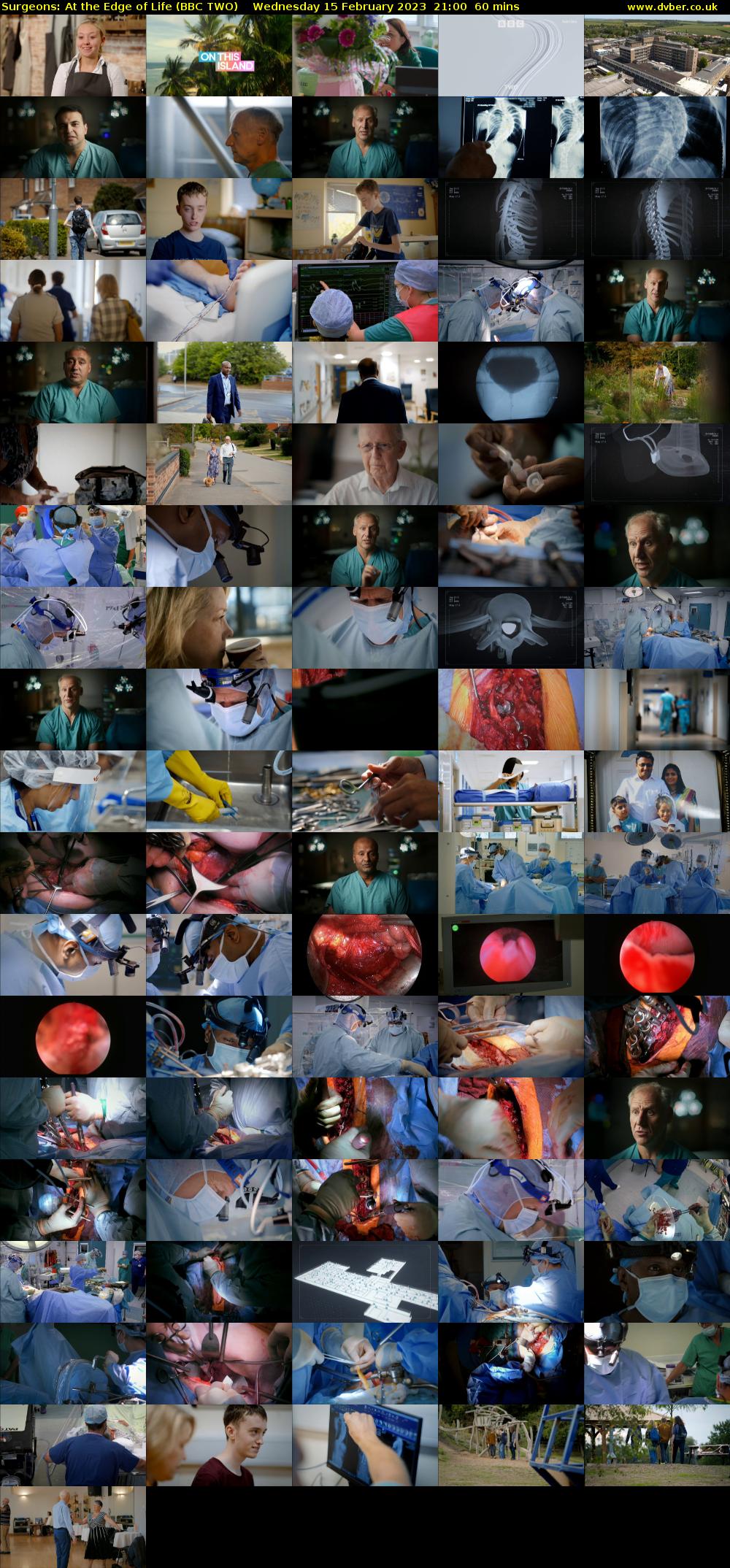 Surgeons: At the Edge of Life (BBC TWO) Wednesday 15 February 2023 21:00 - 22:00