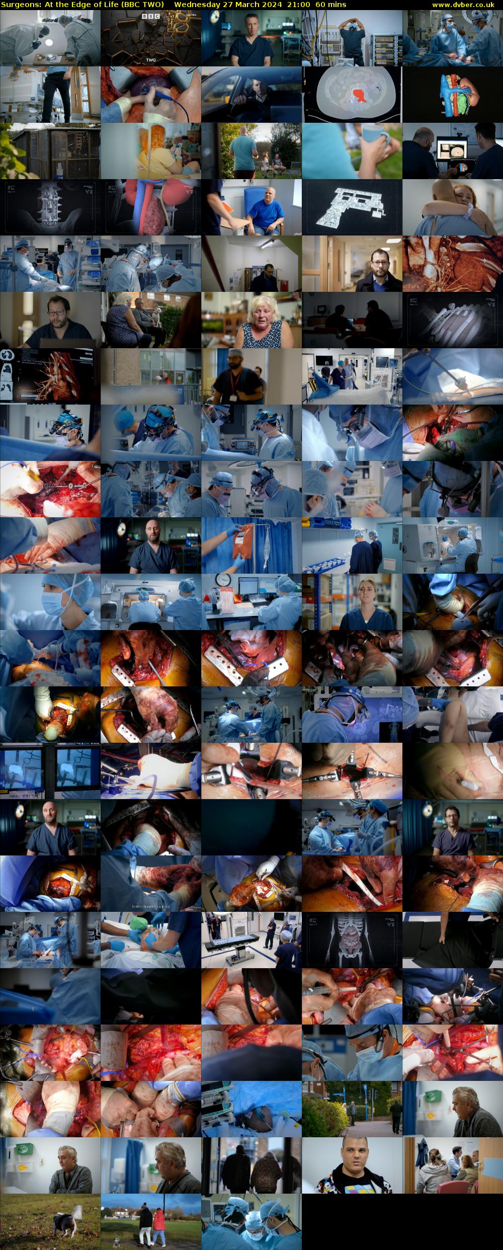 Surgeons: At the Edge of Life (BBC TWO) Wednesday 27 March 2024 21:00 - 22:00