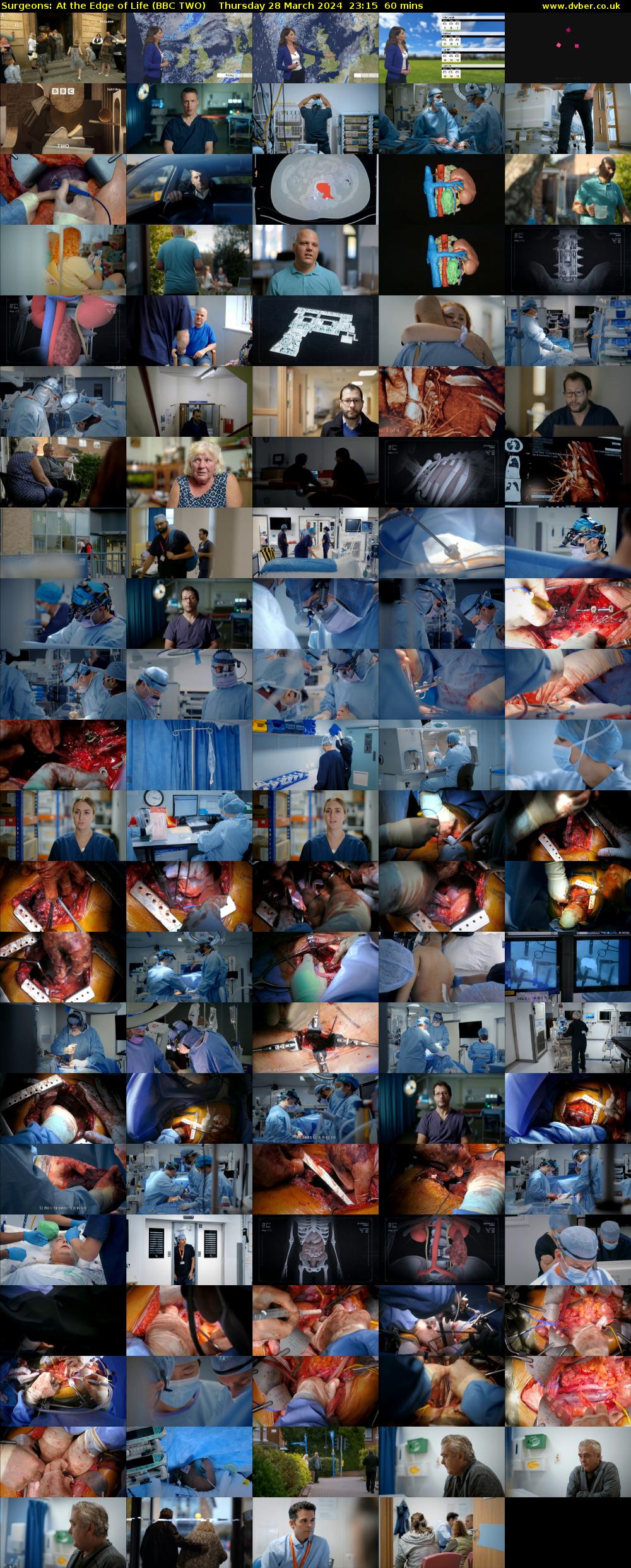 Surgeons: At the Edge of Life (BBC TWO) Thursday 28 March 2024 23:15 - 00:15