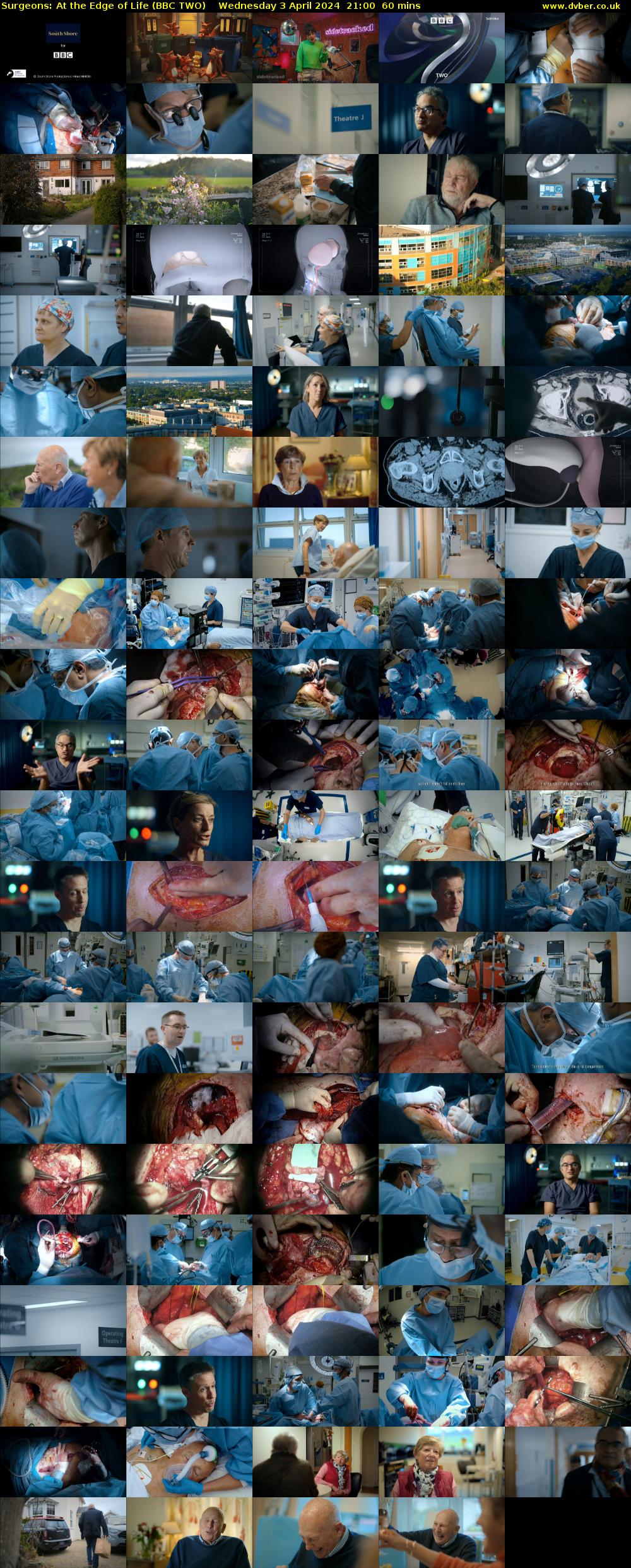 Surgeons: At the Edge of Life (BBC TWO) Wednesday 3 April 2024 21:00 - 22:00