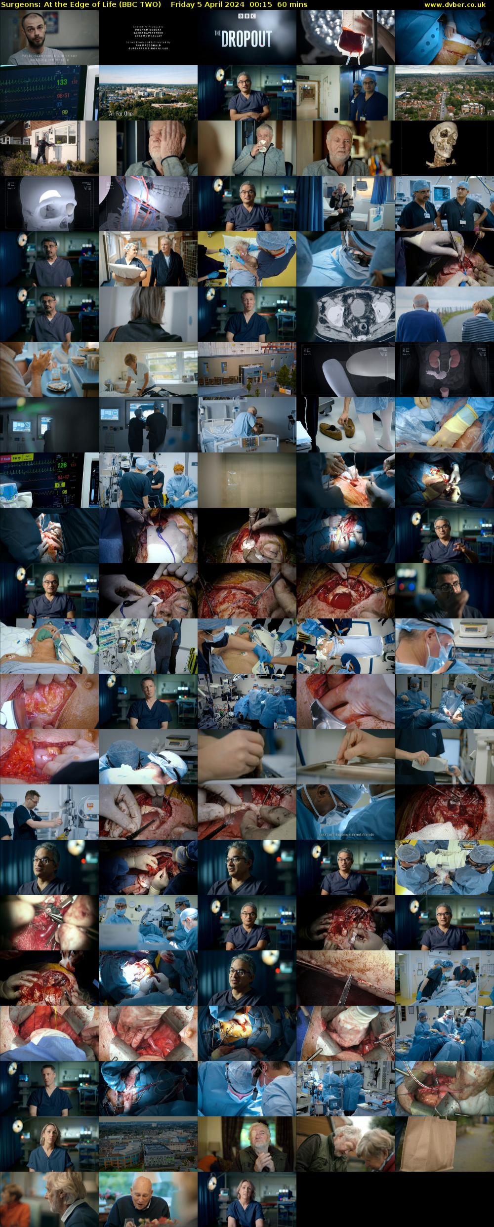 Surgeons: At the Edge of Life (BBC TWO) Friday 5 April 2024 00:15 - 01:15