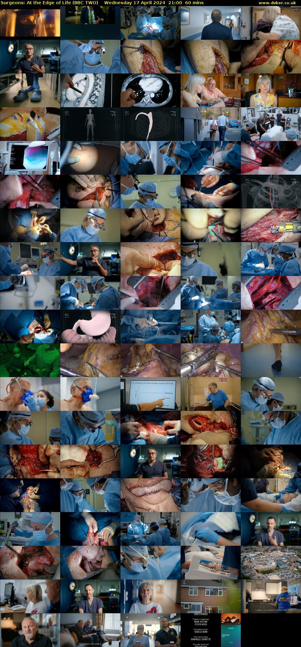 Surgeons: At the Edge of Life (BBC TWO) Wednesday 17 April 2024 21:00 - 22:00