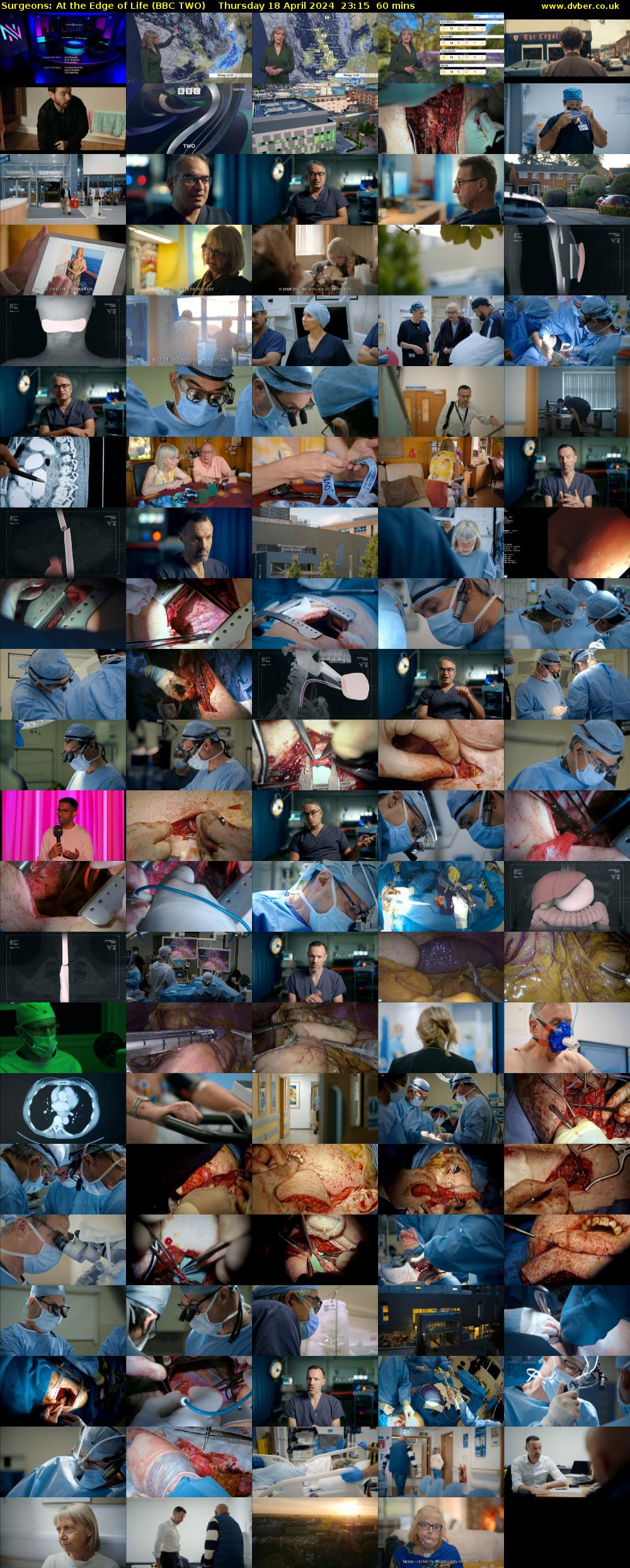 Surgeons: At the Edge of Life (BBC TWO) Thursday 18 April 2024 23:15 - 00:15