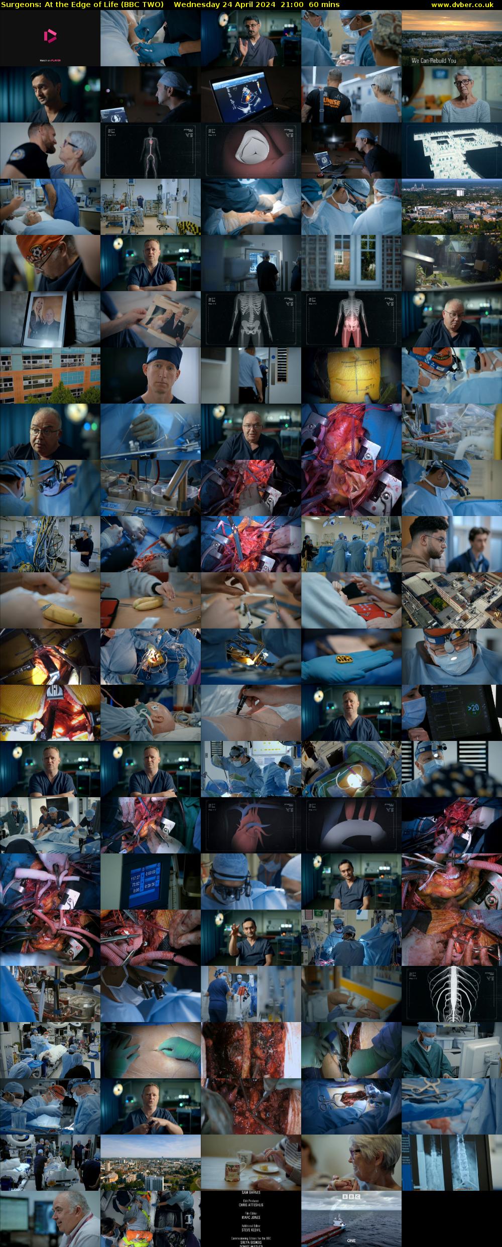 Surgeons: At the Edge of Life (BBC TWO) Wednesday 24 April 2024 21:00 - 22:00