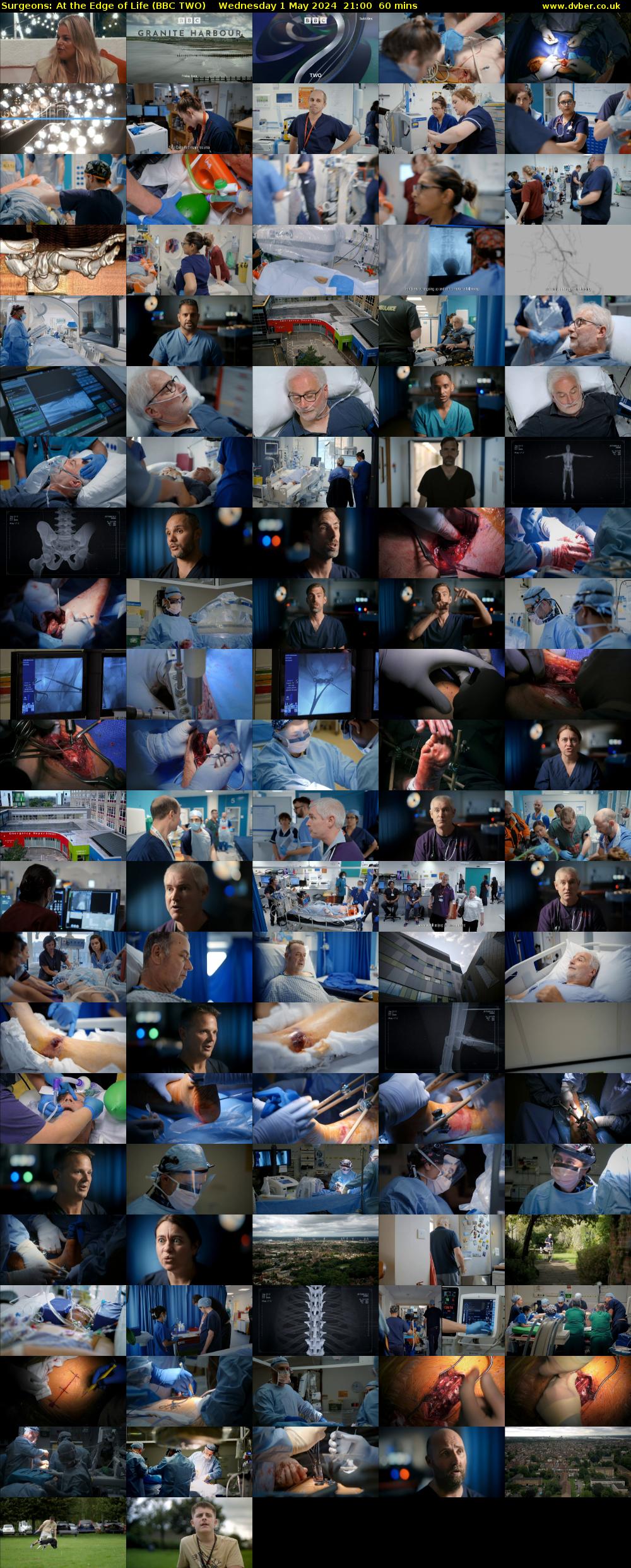 Surgeons: At the Edge of Life (BBC TWO) Wednesday 1 May 2024 21:00 - 22:00