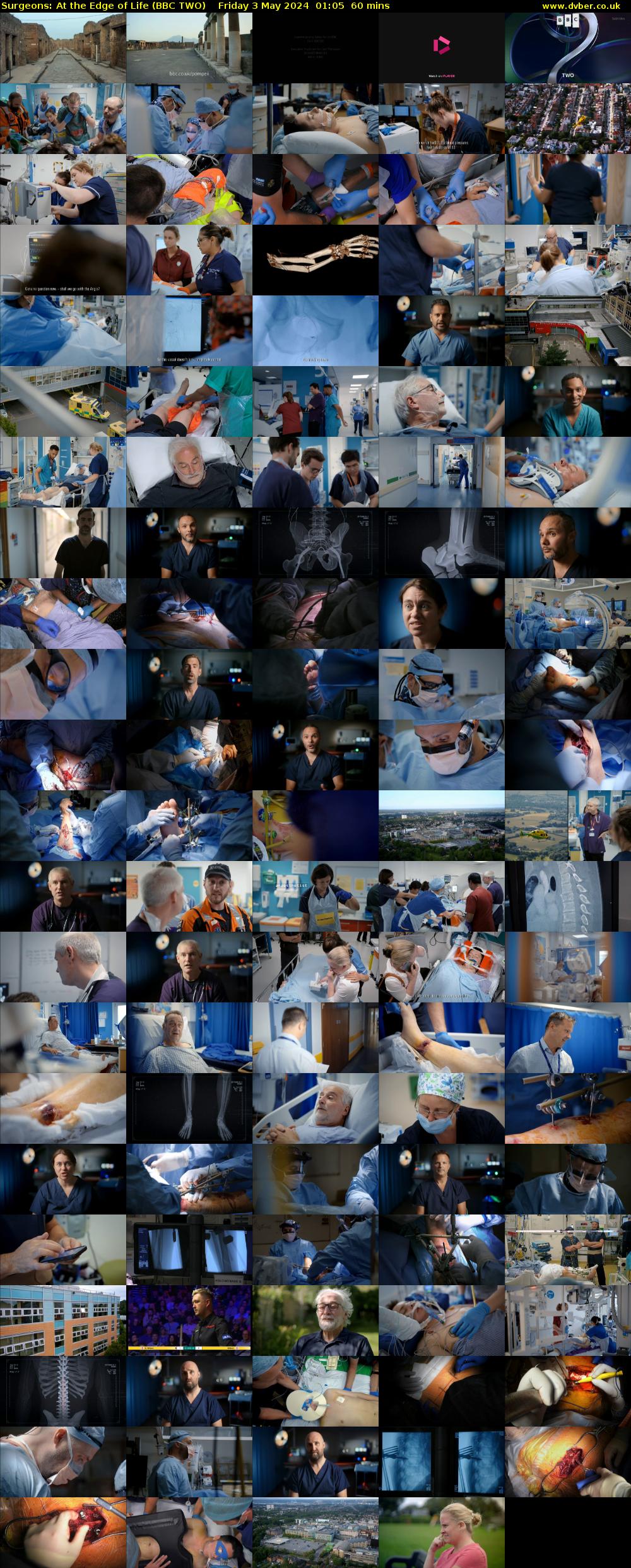 Surgeons: At the Edge of Life (BBC TWO) Friday 3 May 2024 01:05 - 02:05