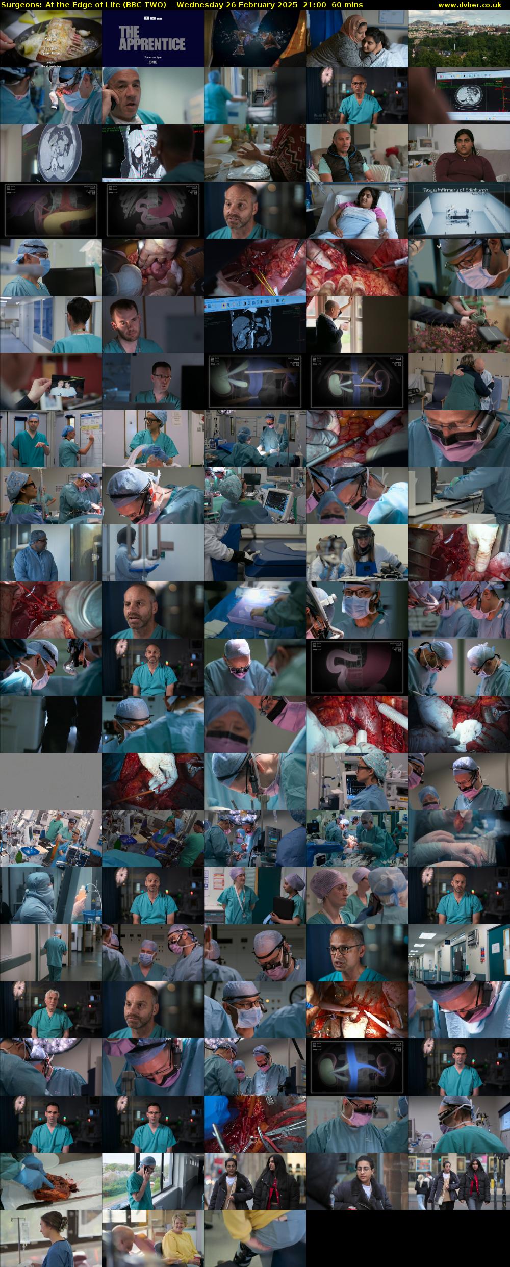Surgeons: At the Edge of Life (BBC TWO) Wednesday 26 February 2025 21:00 - 22:00