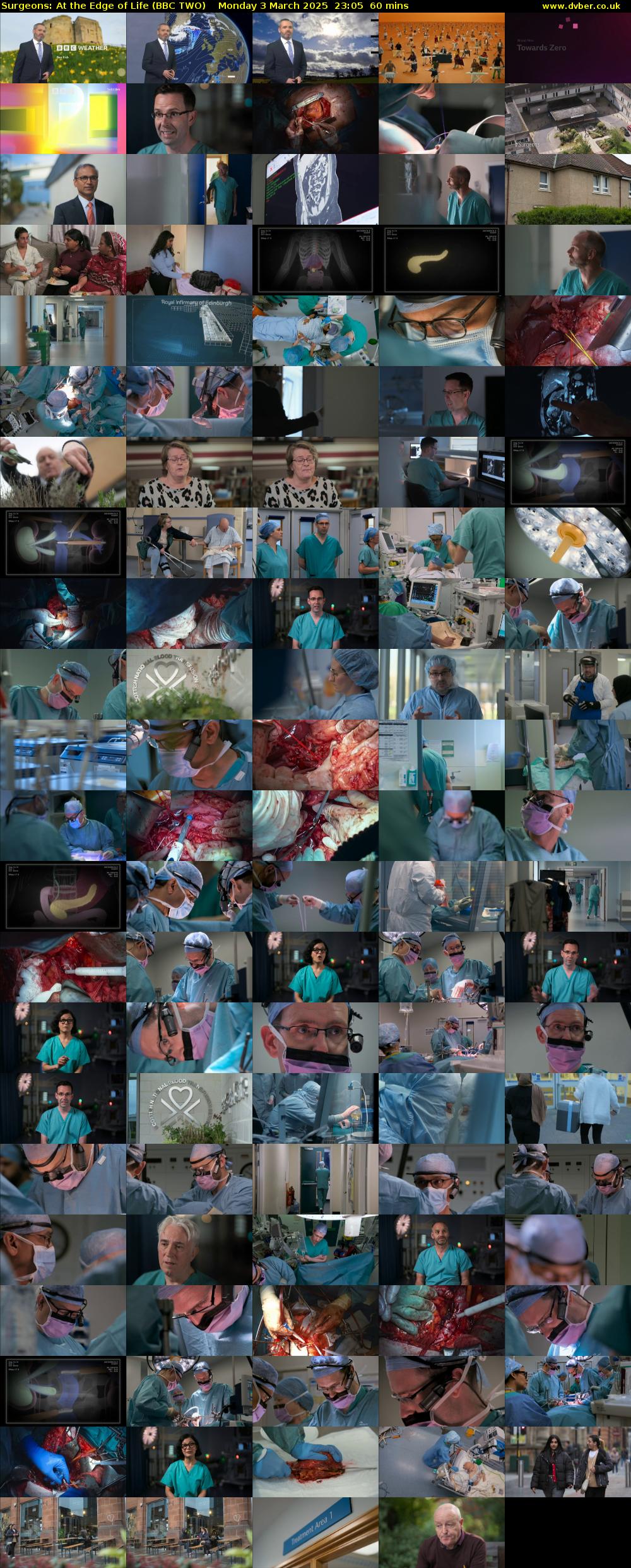 Surgeons: At the Edge of Life (BBC TWO) Monday 3 March 2025 23:05 - 00:05