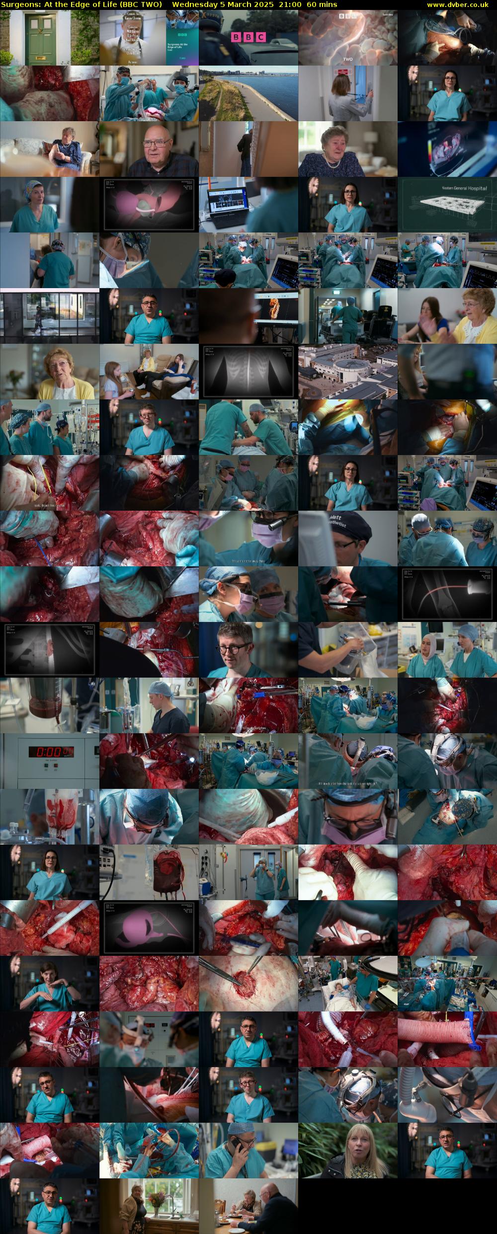 Surgeons: At the Edge of Life (BBC TWO) Wednesday 5 March 2025 21:00 - 22:00