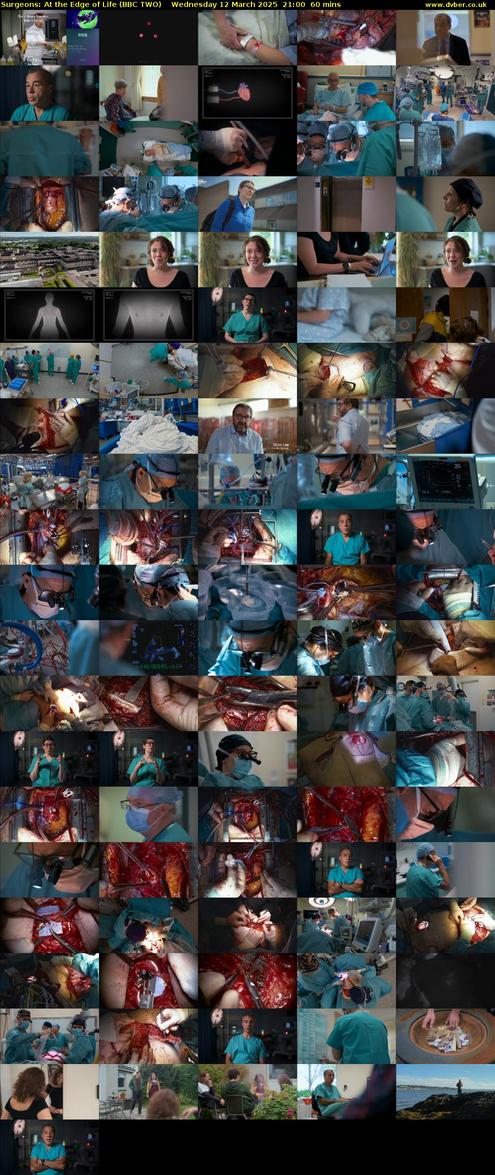 Surgeons: At the Edge of Life (BBC TWO) Wednesday 12 March 2025 21:00 - 22:00