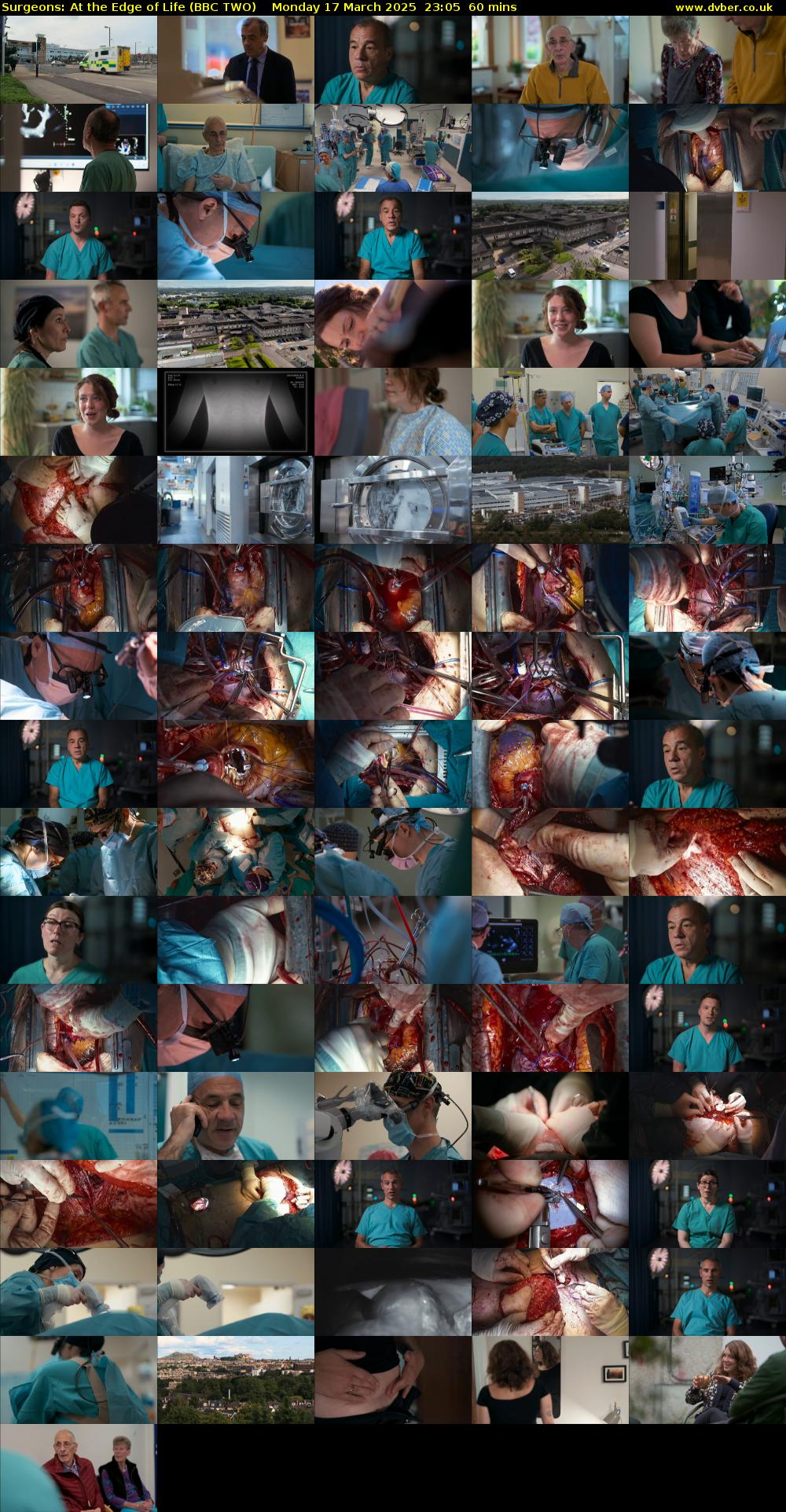 Surgeons: At the Edge of Life (BBC TWO) Monday 17 March 2025 23:05 - 00:05