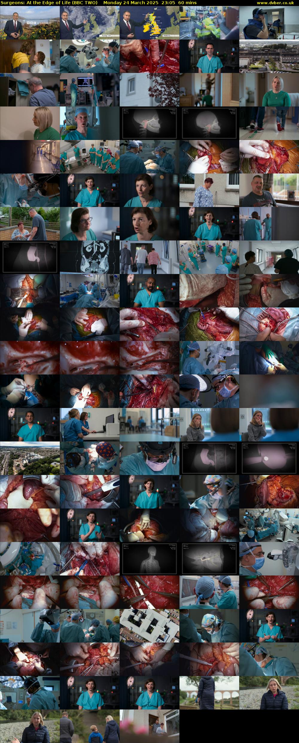 Surgeons: At the Edge of Life (BBC TWO) Monday 24 March 2025 23:05 - 00:05