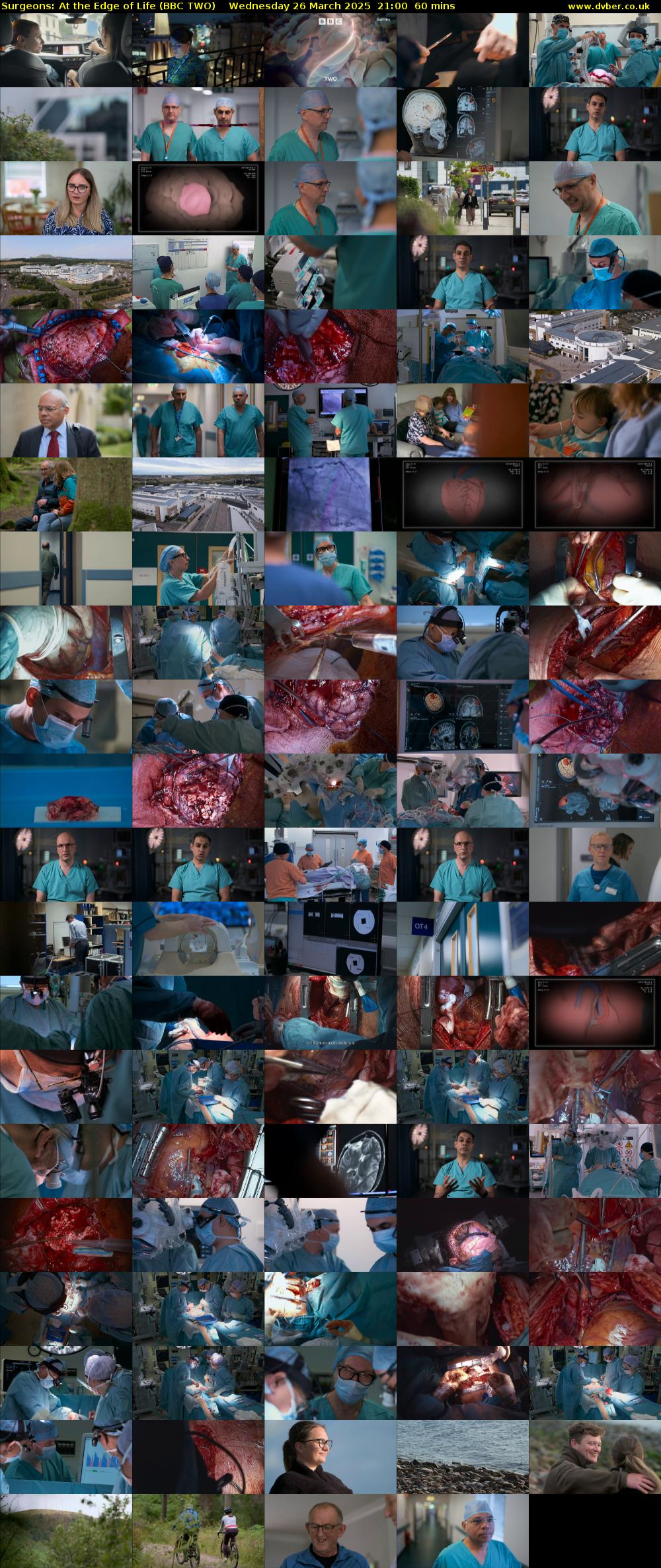 Surgeons: At the Edge of Life (BBC TWO) Wednesday 26 March 2025 21:00 - 22:00