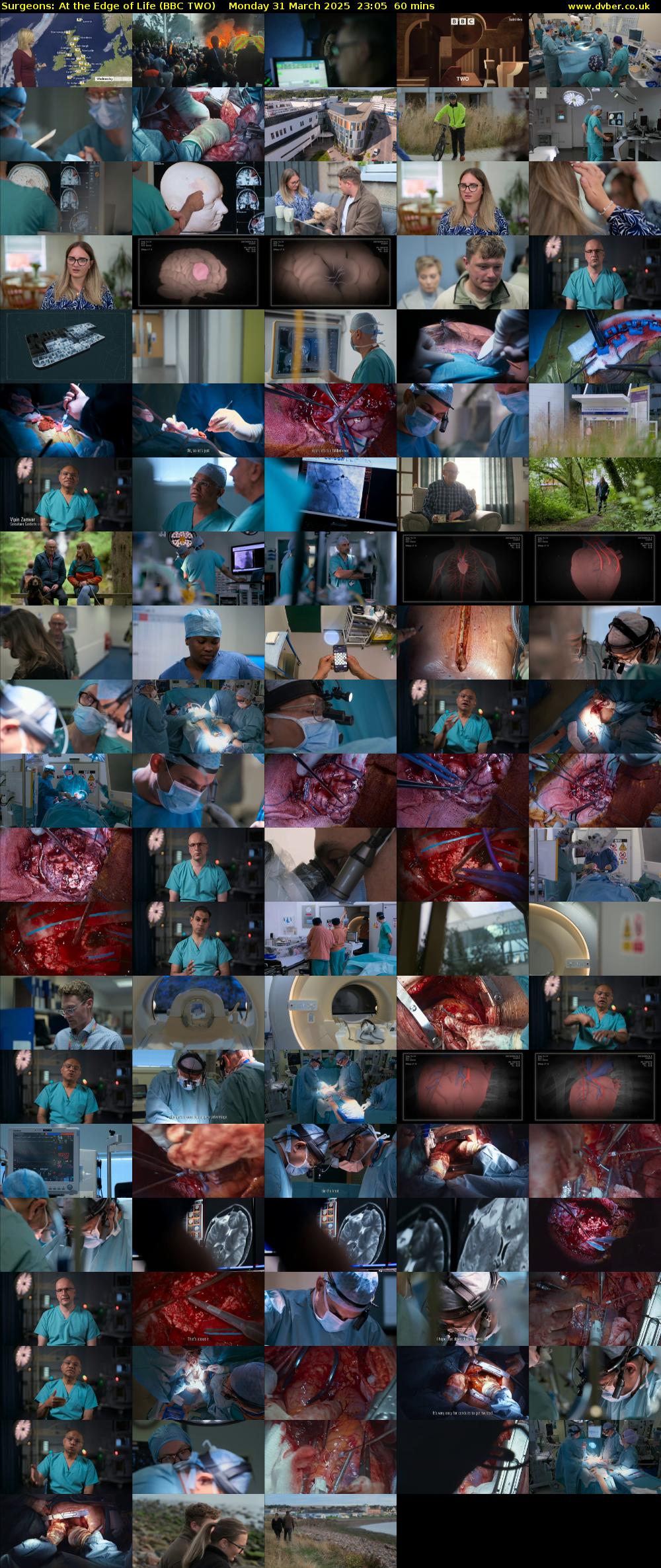 Surgeons: At the Edge of Life (BBC TWO) Monday 31 March 2025 23:05 - 00:05