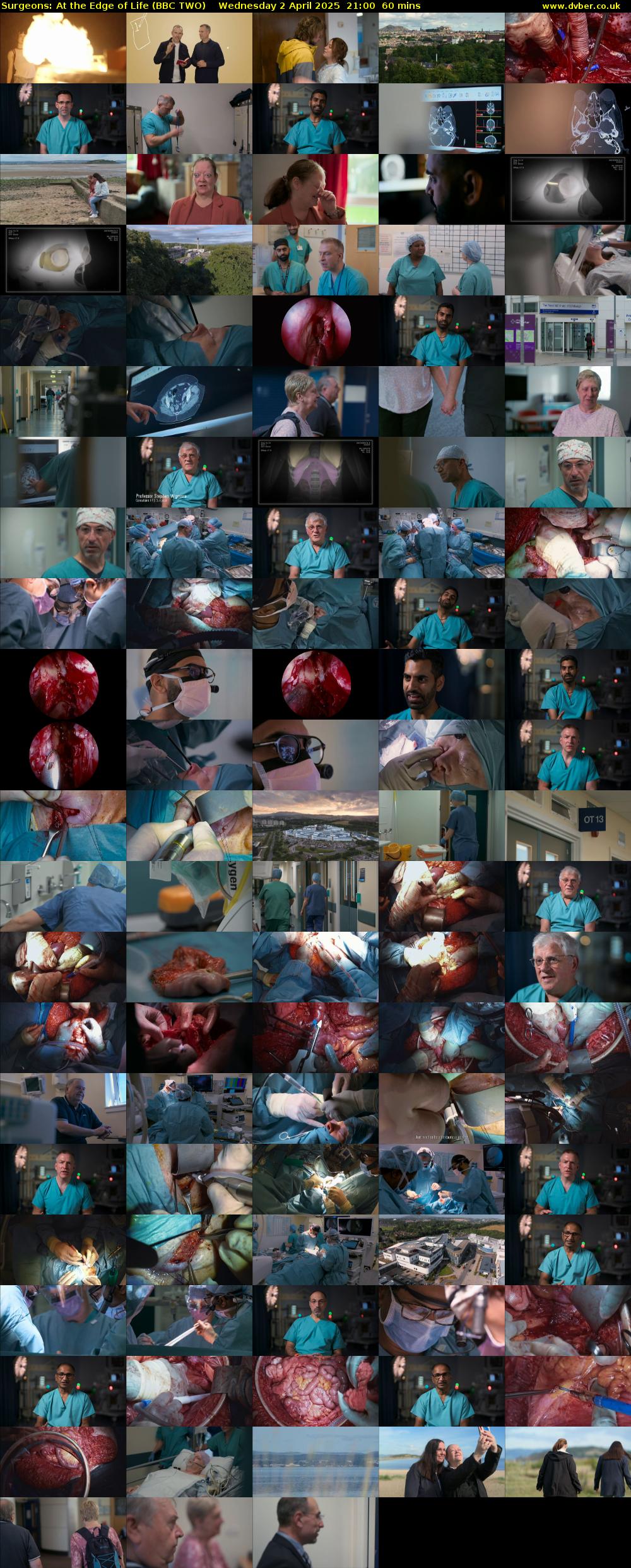 Surgeons: At the Edge of Life (BBC TWO) Wednesday 2 April 2025 21:00 - 22:00