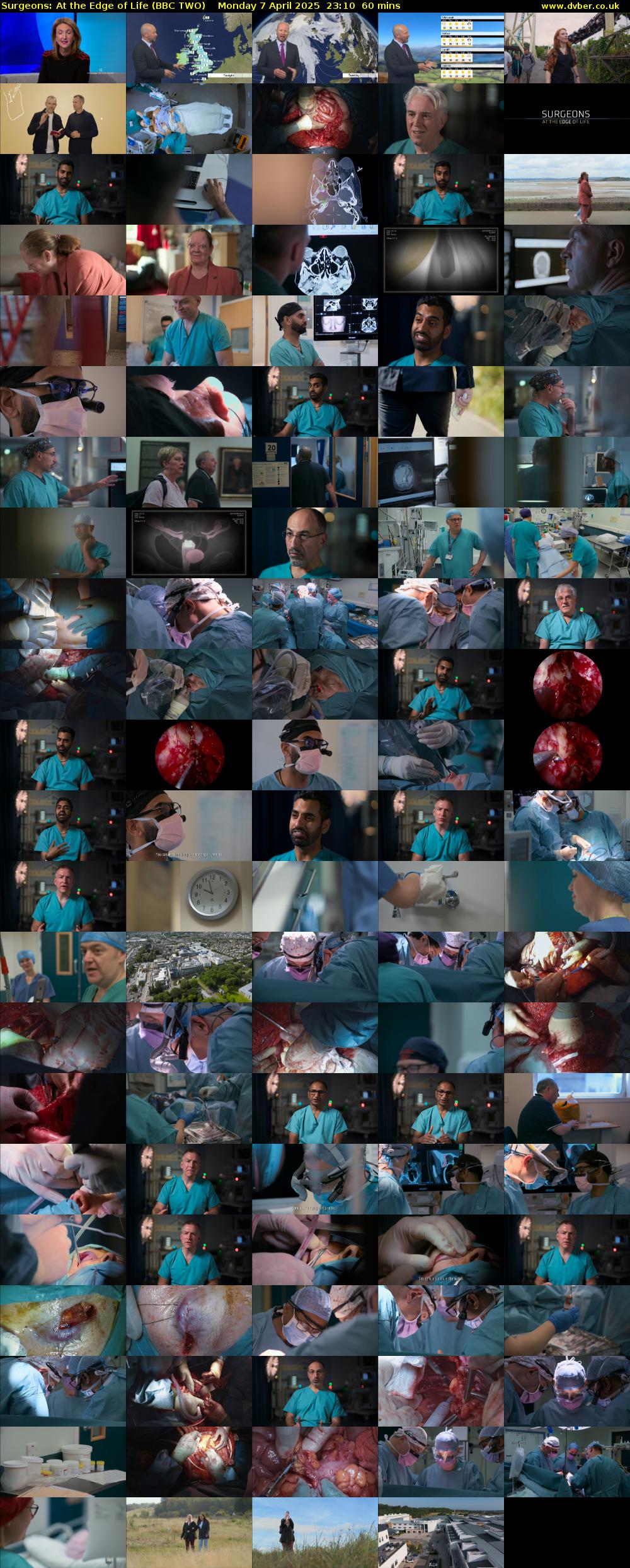 Surgeons: At the Edge of Life (BBC TWO) Monday 7 April 2025 23:10 - 00:10