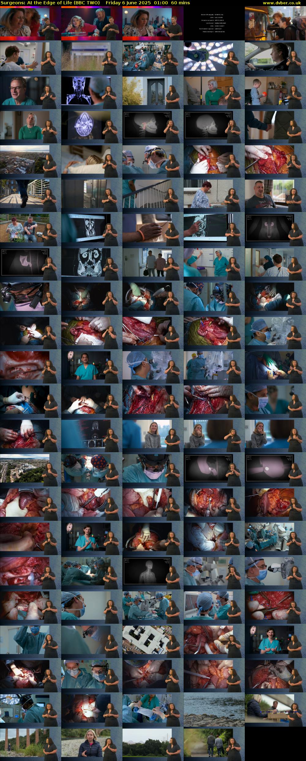 Surgeons: At the Edge of Life (BBC TWO) Friday 6 June 2025 01:00 - 02:00