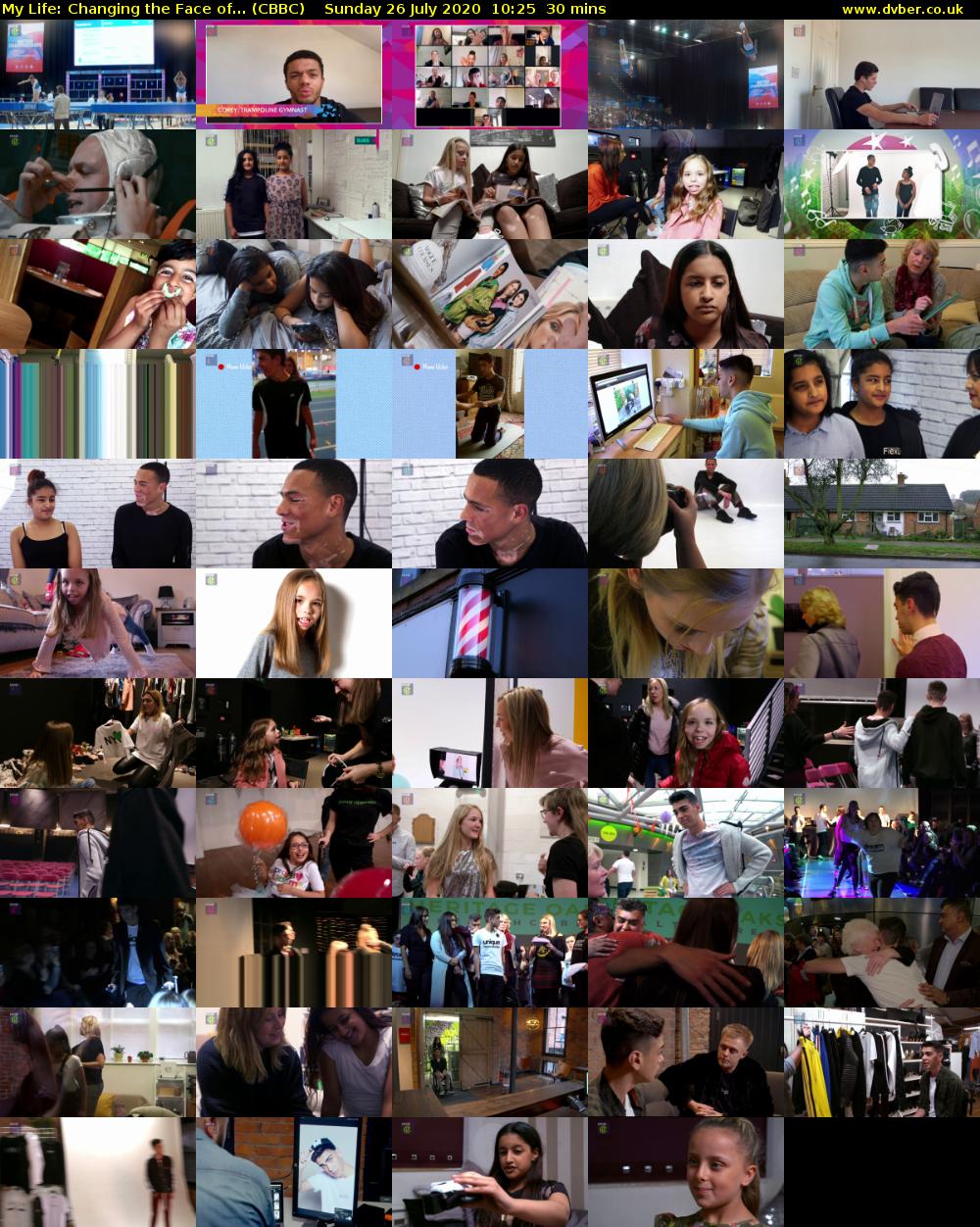 My Life: Changing the Face of... (CBBC) Sunday 26 July 2020 10:25 - 10:55