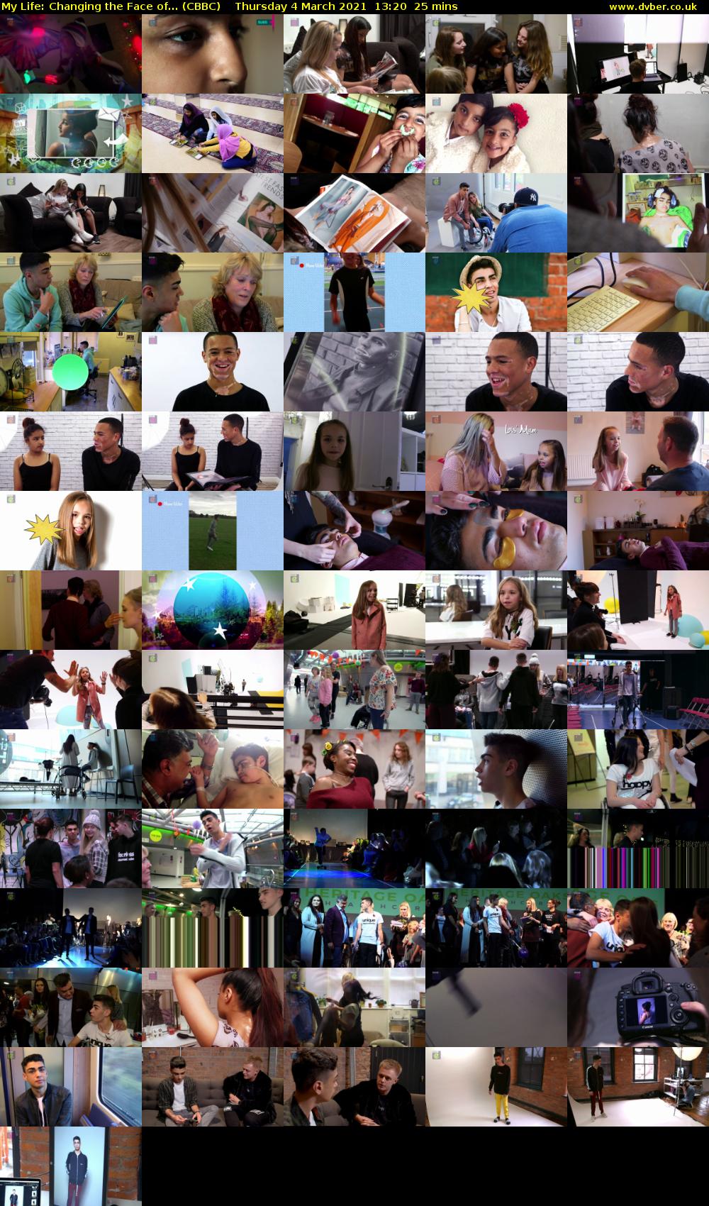My Life: Changing the Face of... (CBBC) Thursday 4 March 2021 13:20 - 13:45
