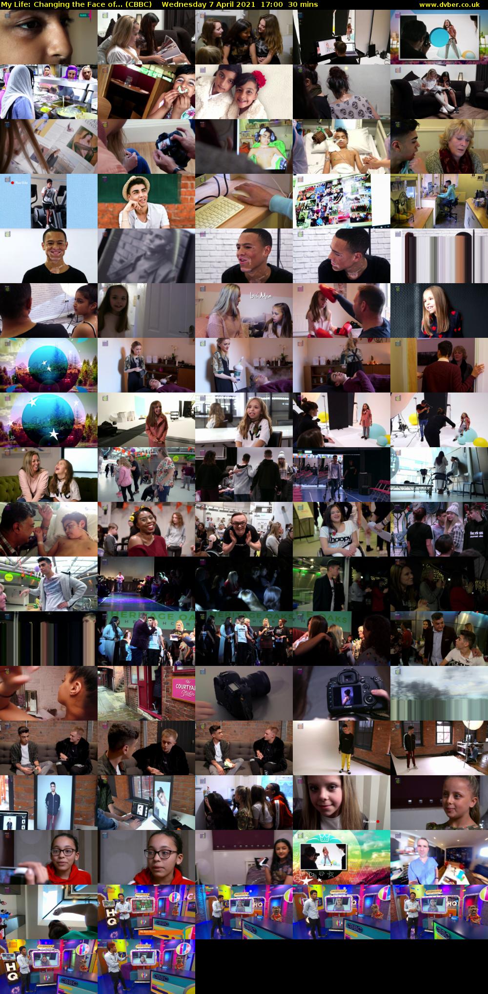 My Life: Changing the Face of... (CBBC) Wednesday 7 April 2021 17:00 - 17:30