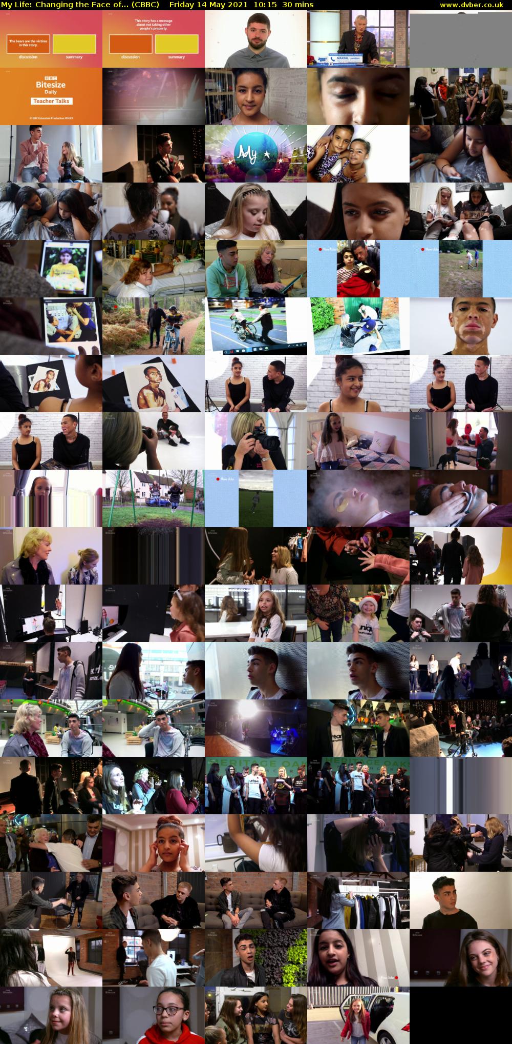 My Life: Changing the Face of... (CBBC) Friday 14 May 2021 10:15 - 10:45